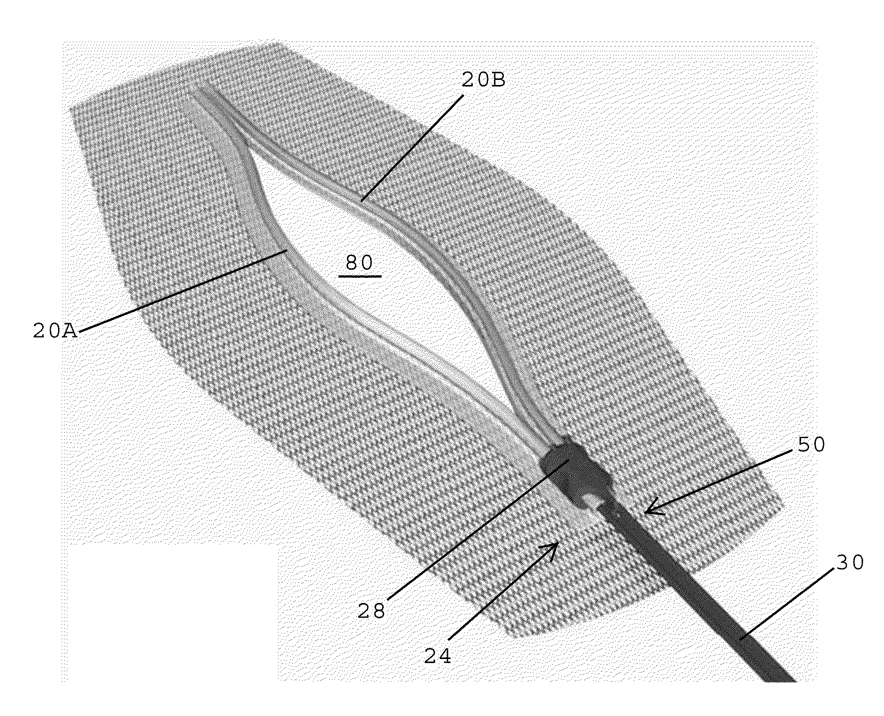 Incision guide and wound closure device and methods therefor