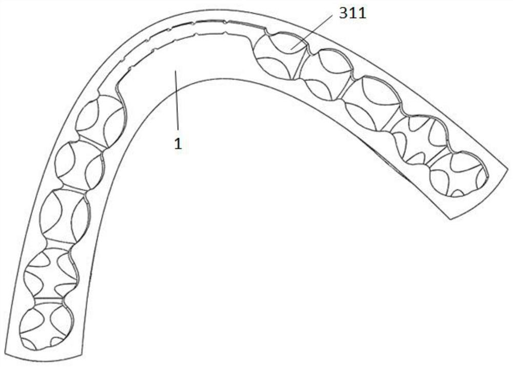 3D printed occlusal splint for the treatment of temporomandibular joint disorders and its preparation method
