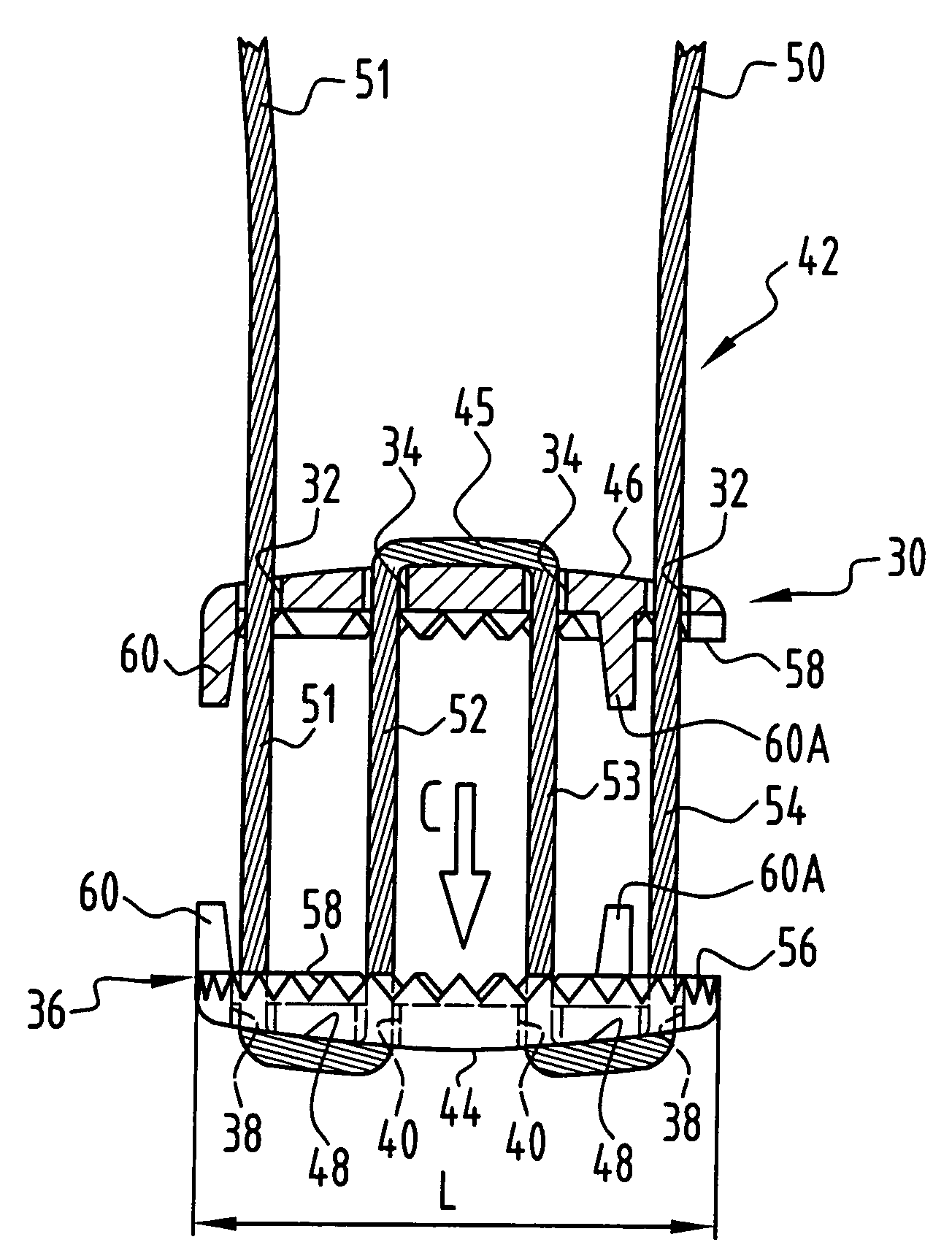 Implant for fixing bone plates