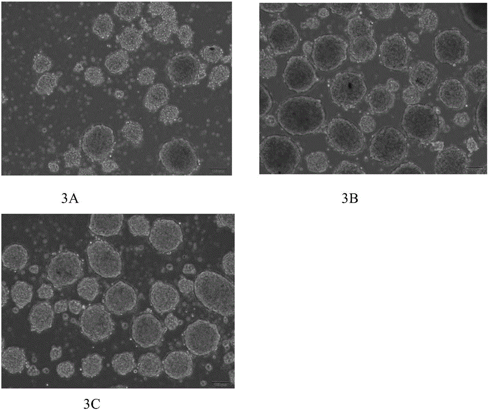 Serum-free medium for inducing differentiation of umbilical cord mesenchymal stem cells into insulin secretory-like cells and preparation method and application thereof