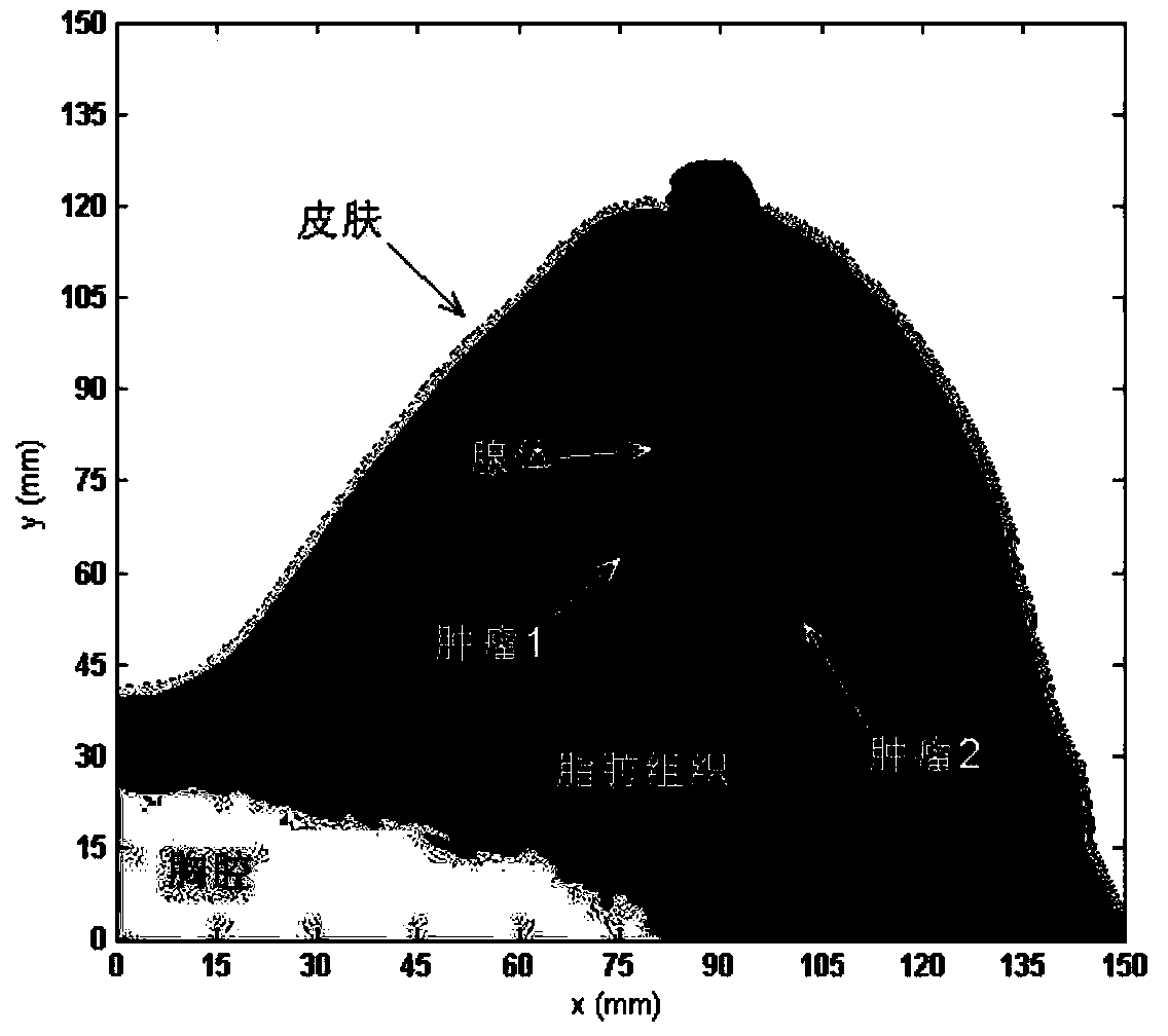 Ultra wide band microwave imaging method for detecting breast multiple tumors