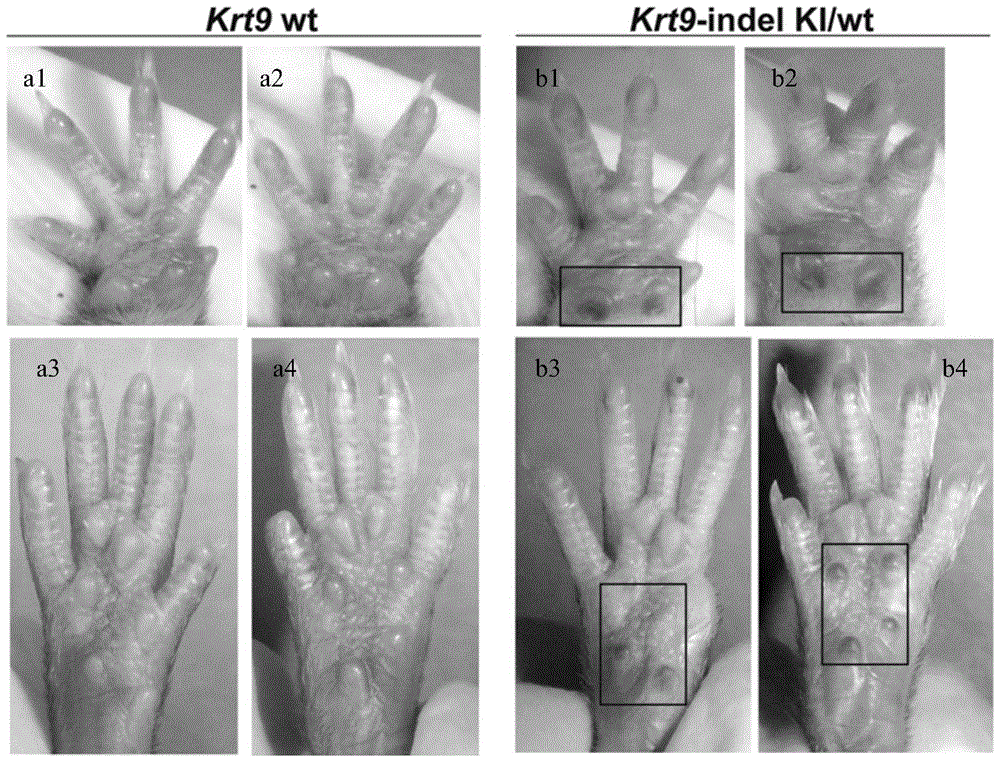 A method for constructing a mouse model of human epidermolysis palmoplantar keratoderma