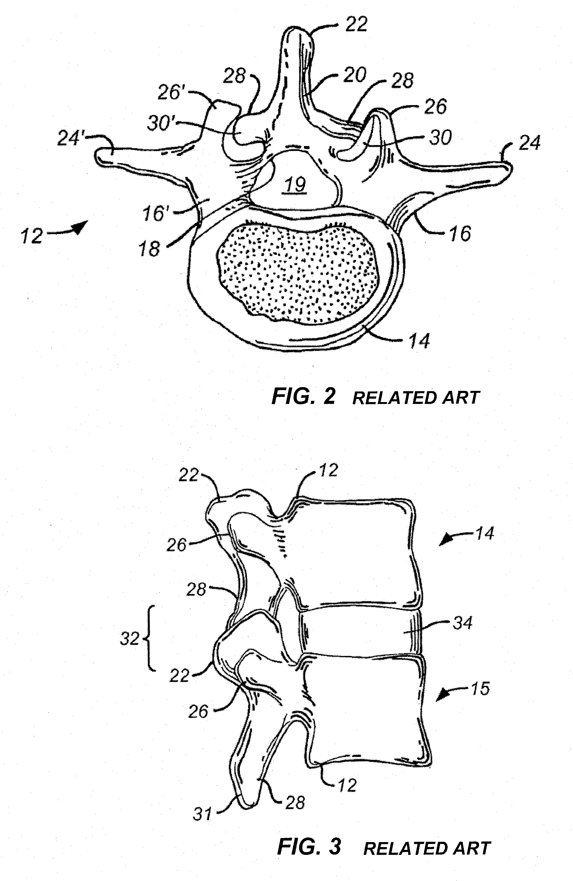 Measurement and trialing system and methods for orthopedic device component selection