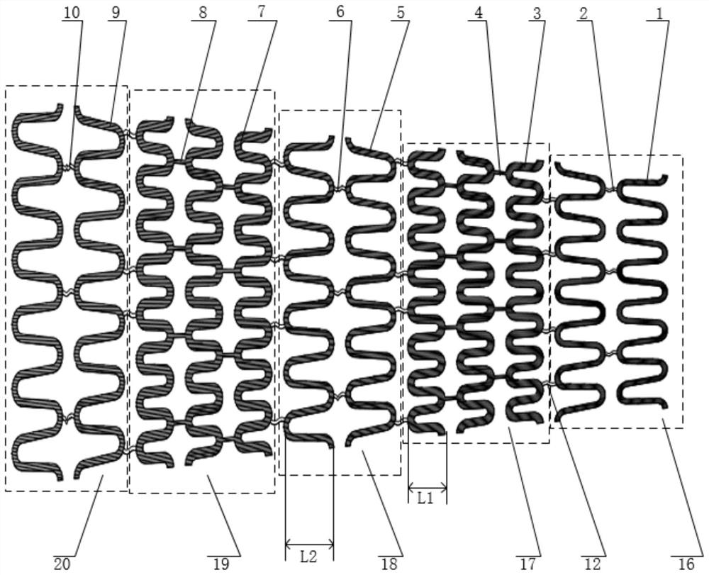 A self-expandable tapered vascular stent for multiple stenosis of tapered blood vessels