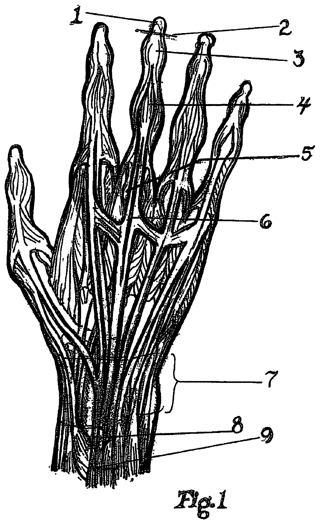 Dynamic taping method for inhibition and elicitation of skeletal muscle tone