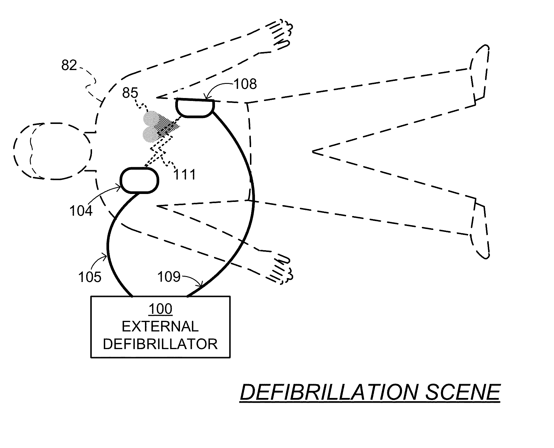 System and method for electrocardiogram analysis and optimization of cardiopulmonary resuscitation and therapy delivery
