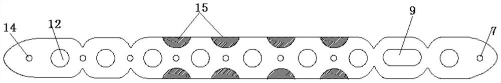 Bone fracture plate for ulna and radius shaft