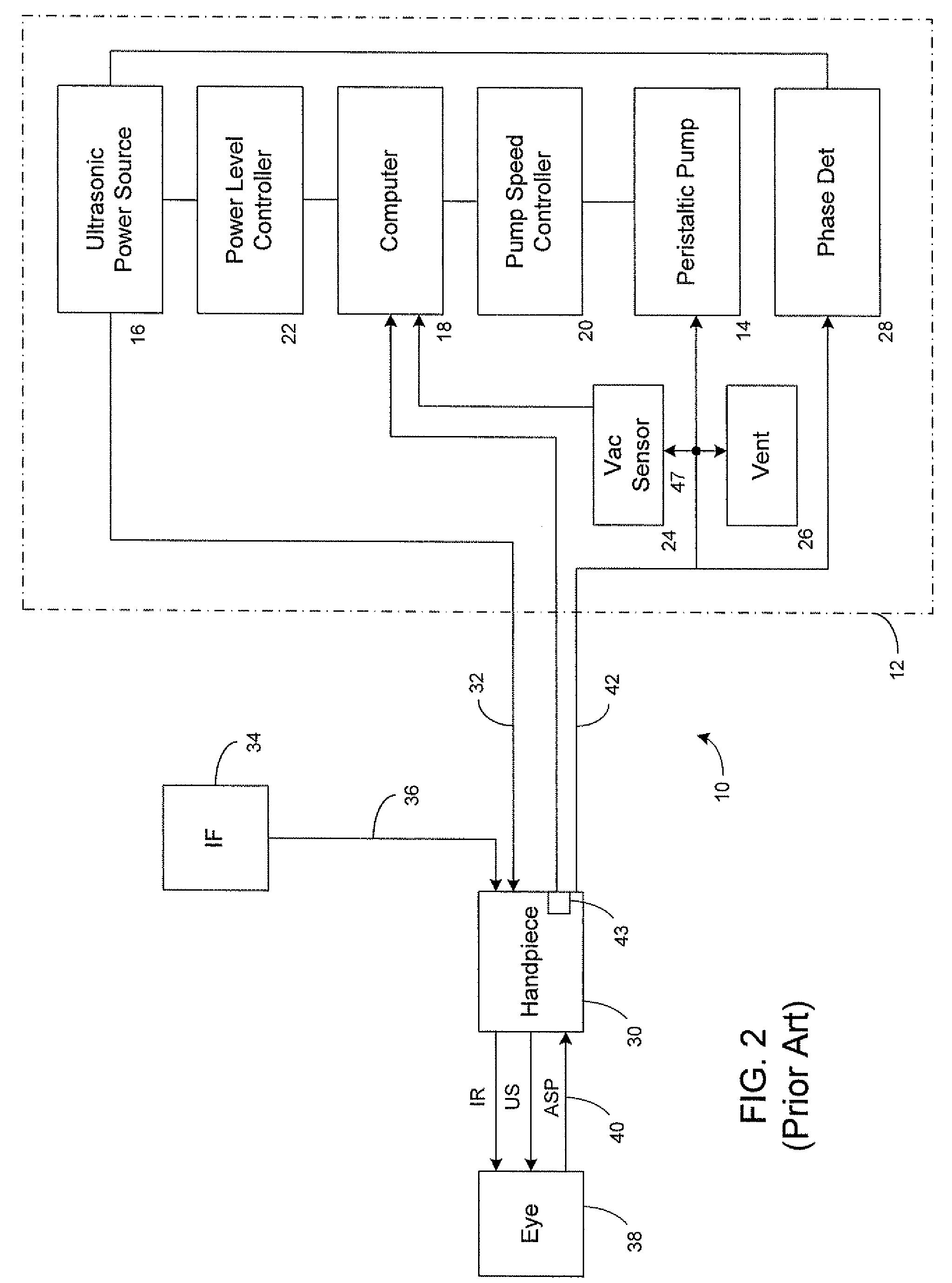 Systems and methods for enhanced occlusion removal during ophthalmic surgery