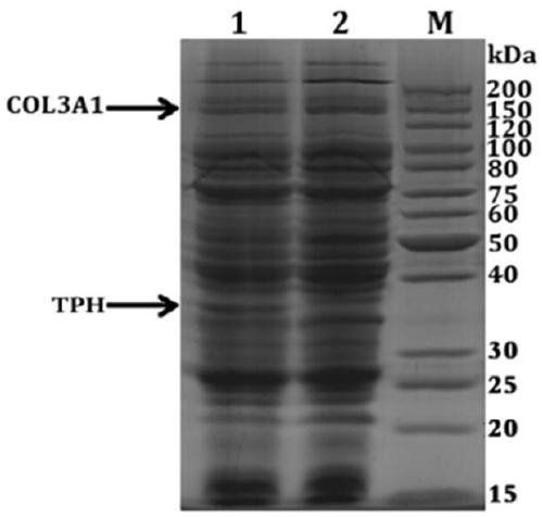 Hydroxylation method of recombinant human-derived collagen