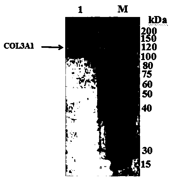 Hydroxylation method of recombinant human-derived collagen