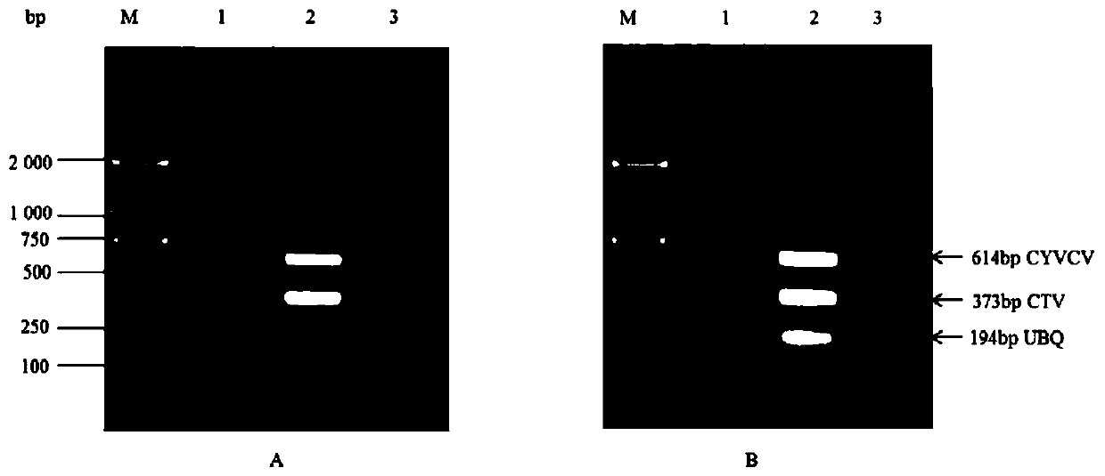 A multiplex RT-PCR method for the simultaneous detection of citrus yellow vein bright virus and decay virus and its application