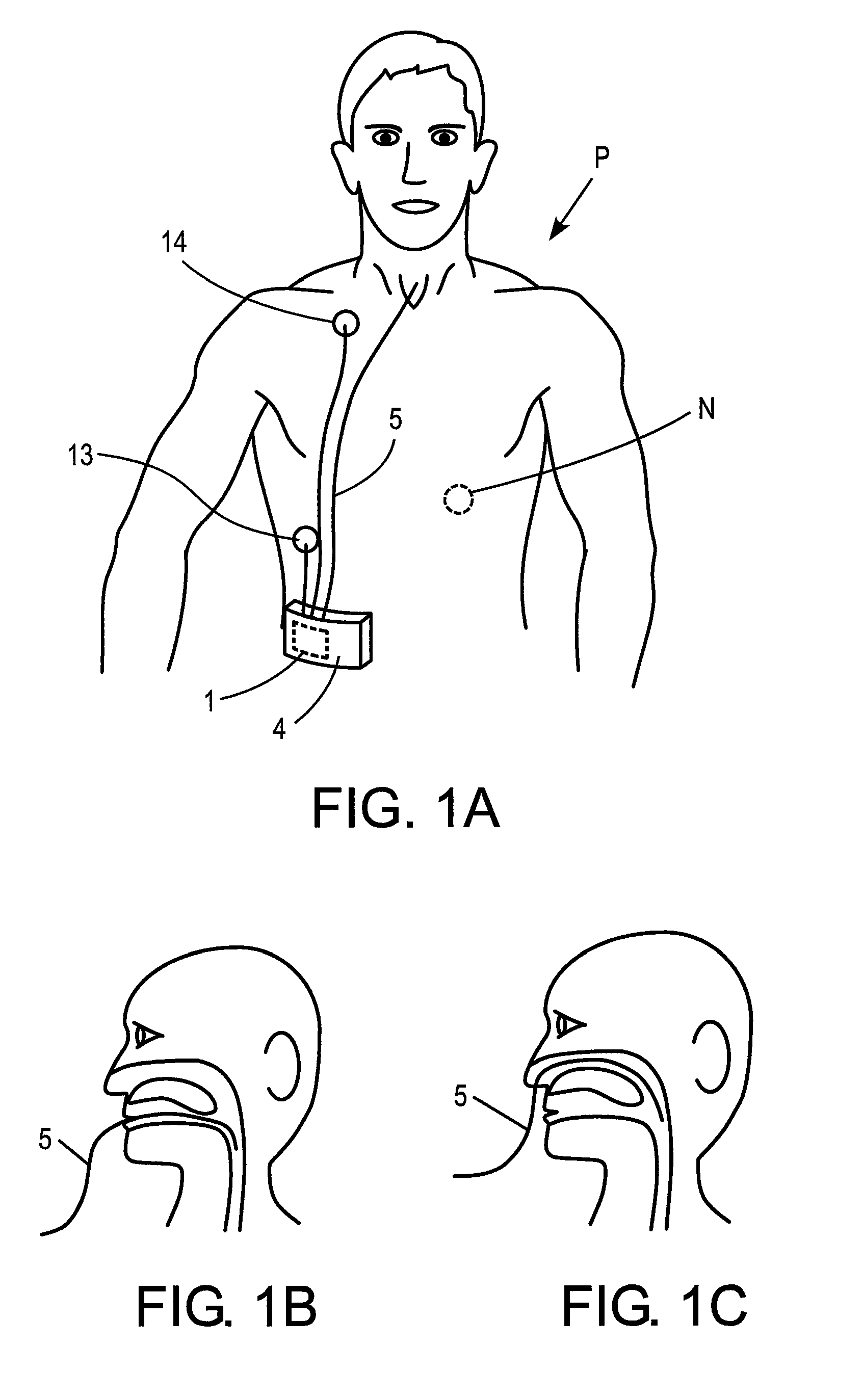 Systems, methods and apparatus for respiratory support of a patient