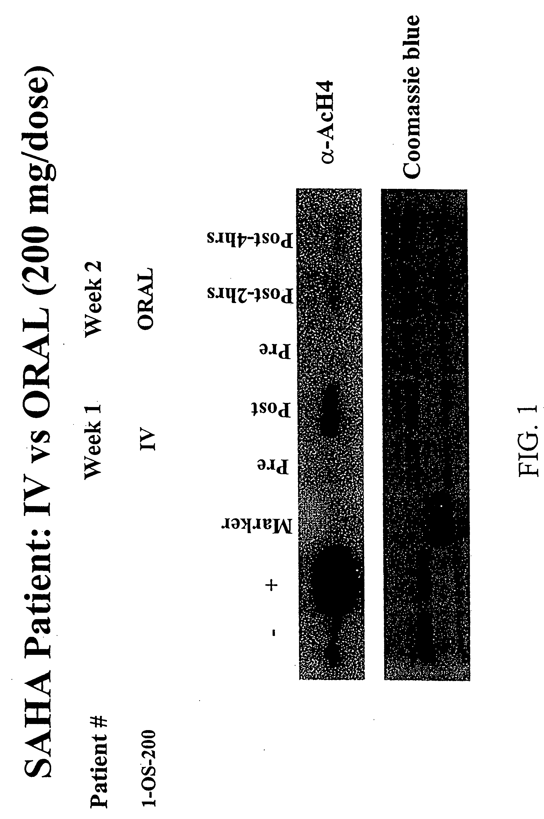 Methods of treating cancer with HDAC inhibitors