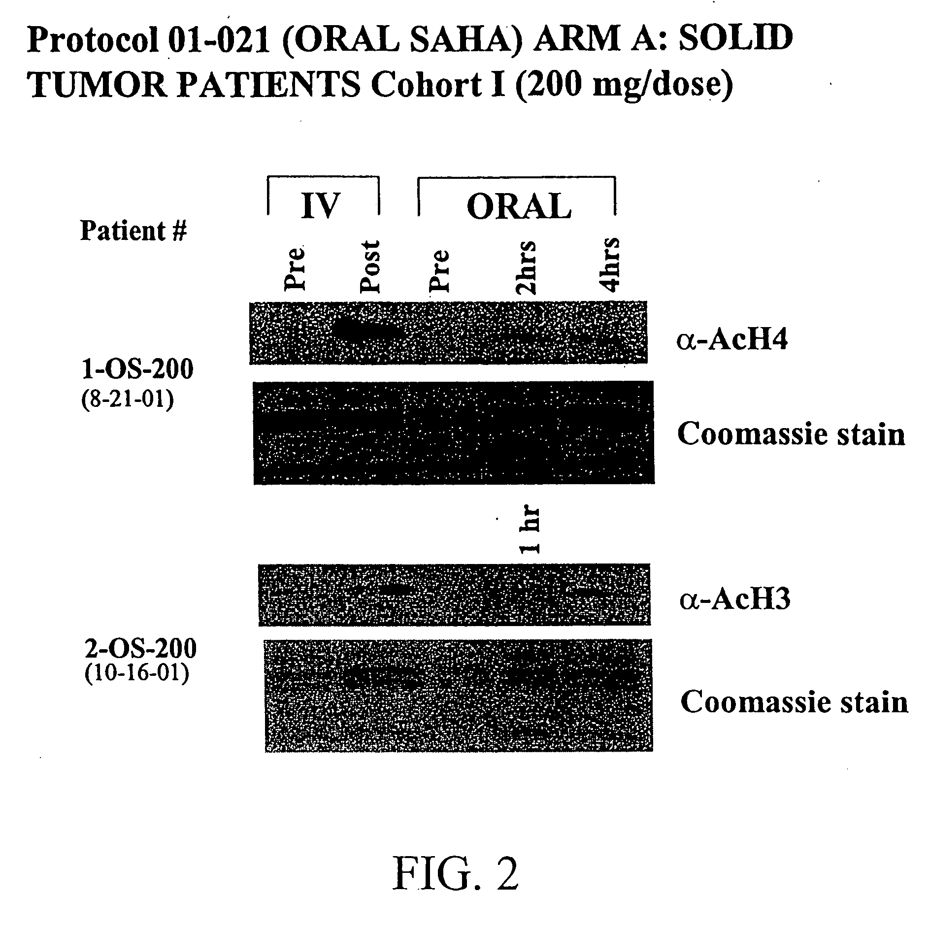 Methods of treating cancer with HDAC inhibitors