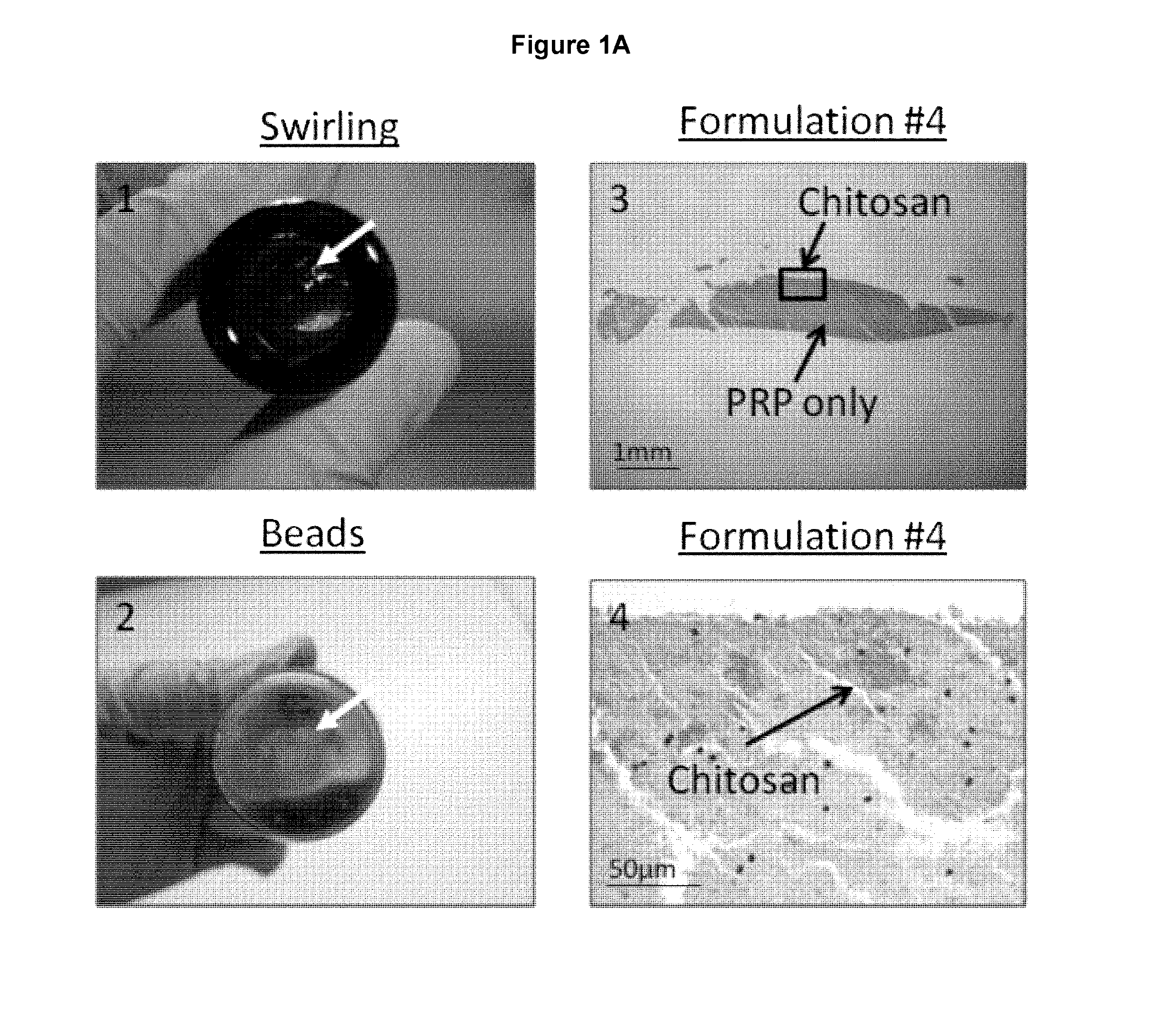 Freeze-dried polymer compositions for mixing with platelet rich plasma to form implants for tissue repair and/or compositions for therapeutic intra-articular injections