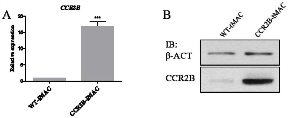 Monocyte and macrophage for expressing chemokine receptor with solid tumor directional chemotactic ability, and preparation and application thereof