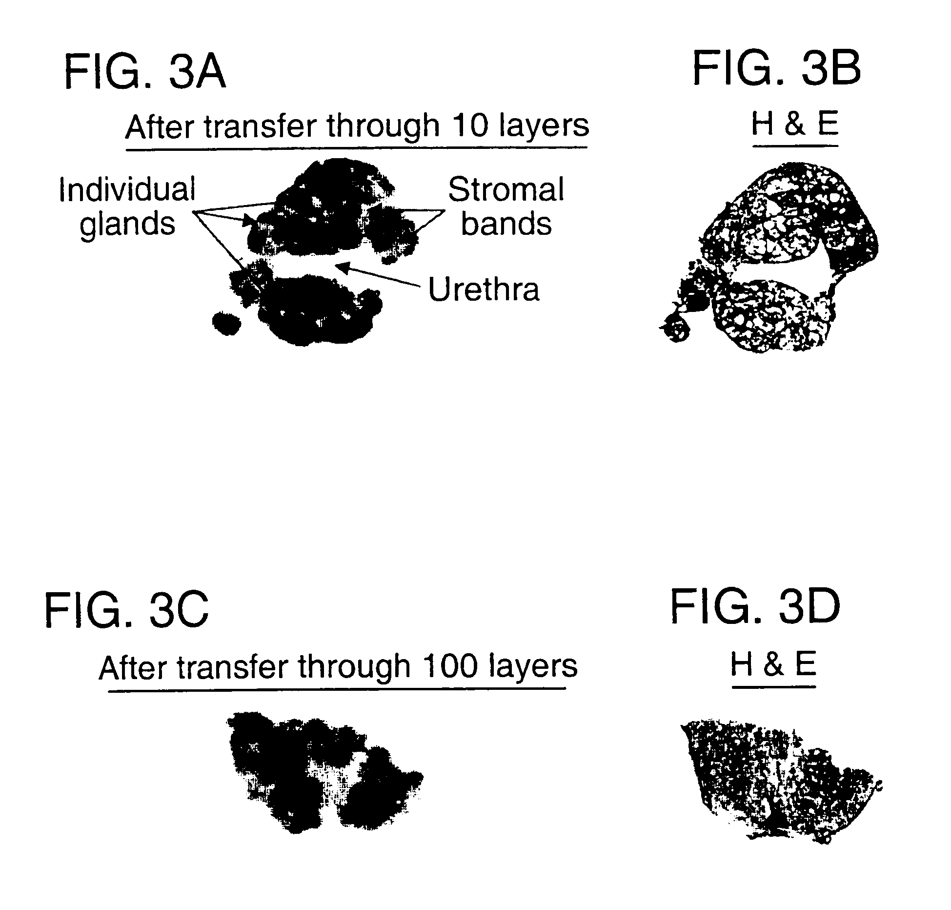 Layered device with capture regions for cellular analysis
