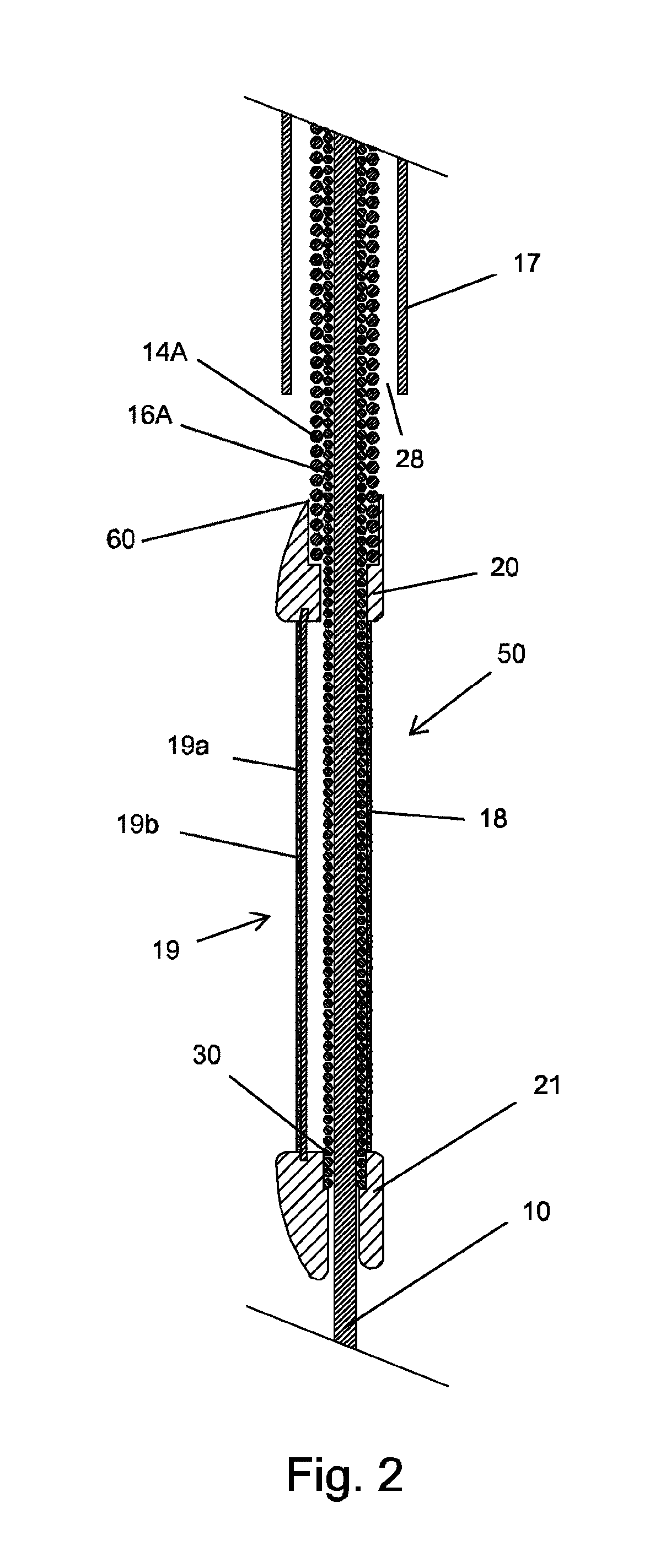 Expandable atherectomy device