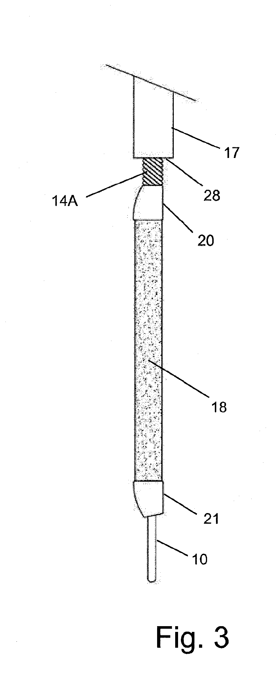 Expandable atherectomy device