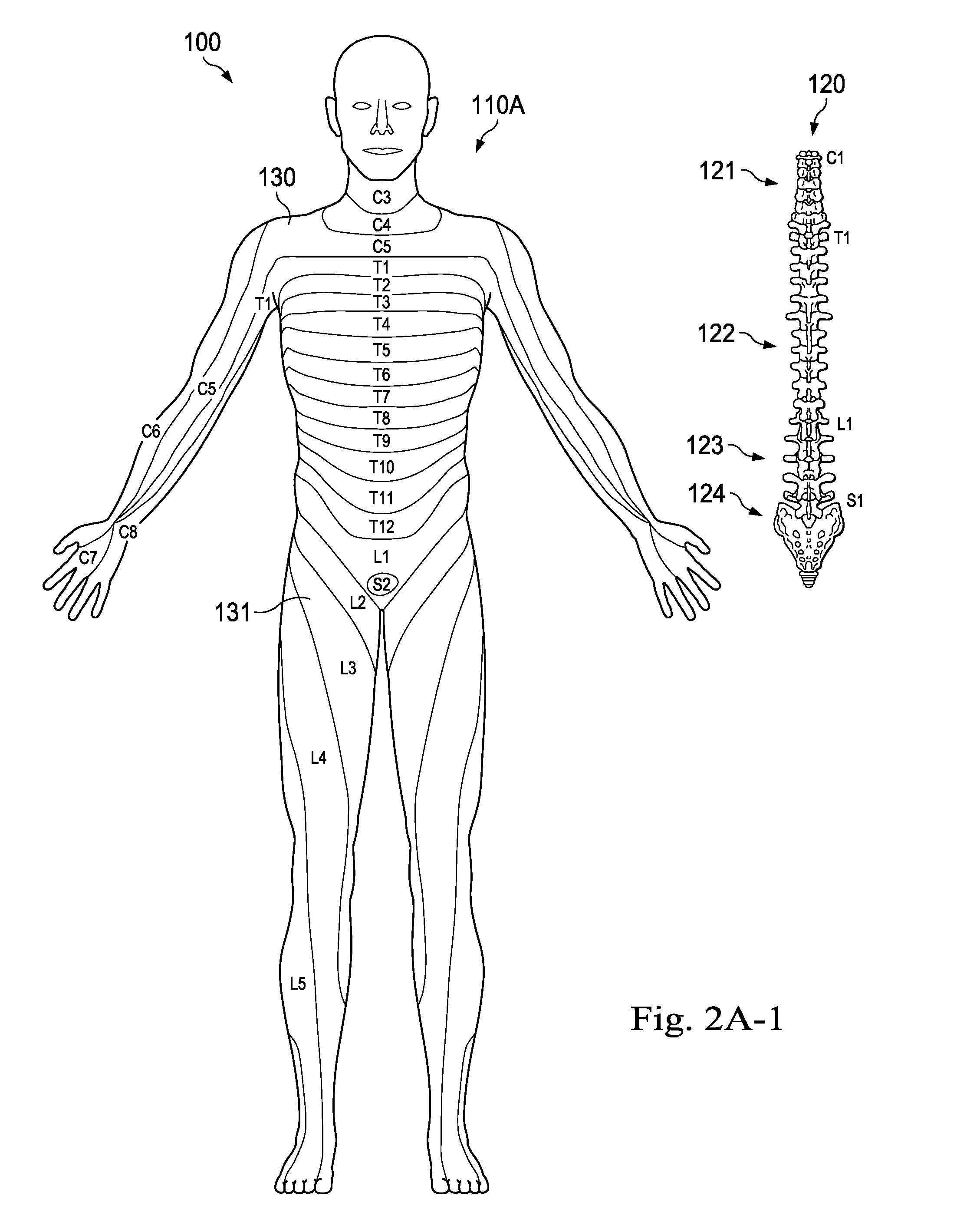 Method and System of Suggesting Spinal Cord Stimulation Region Based on Pain and Stimulation Maps with a Clinician Programmer