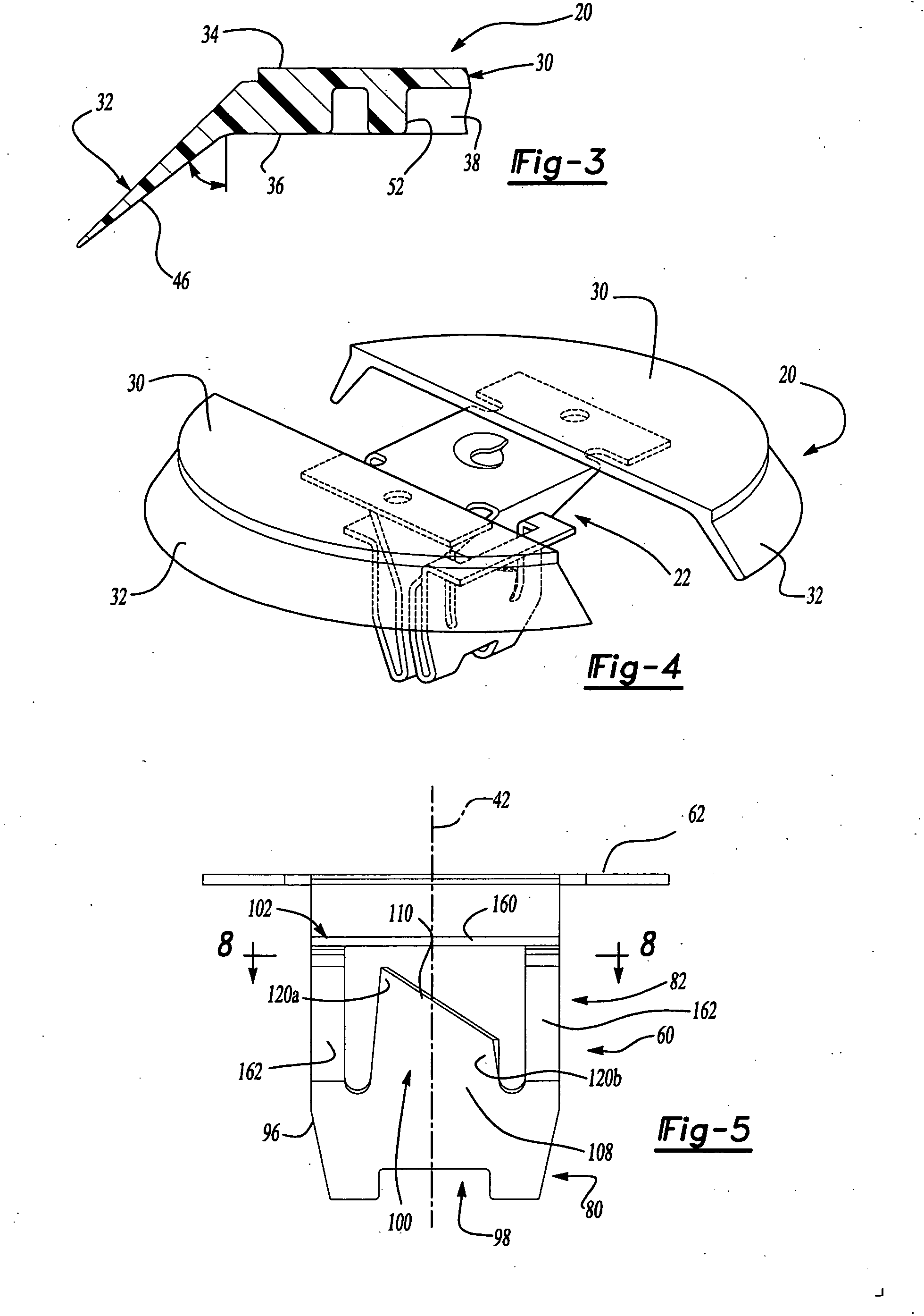 Resilient clip fastener