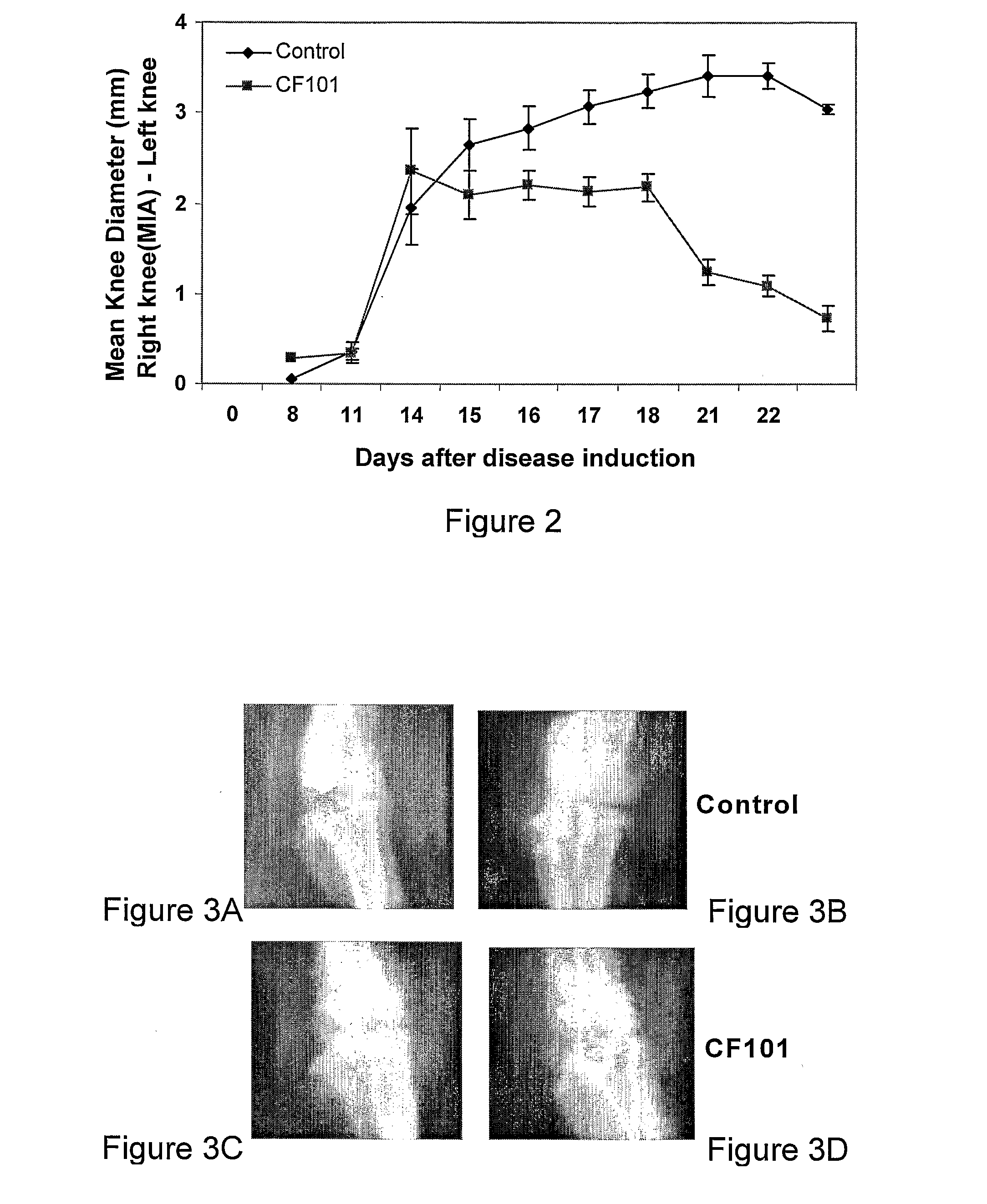 Use of a3 adenosine receptor agonist in osteoarthritis treatment