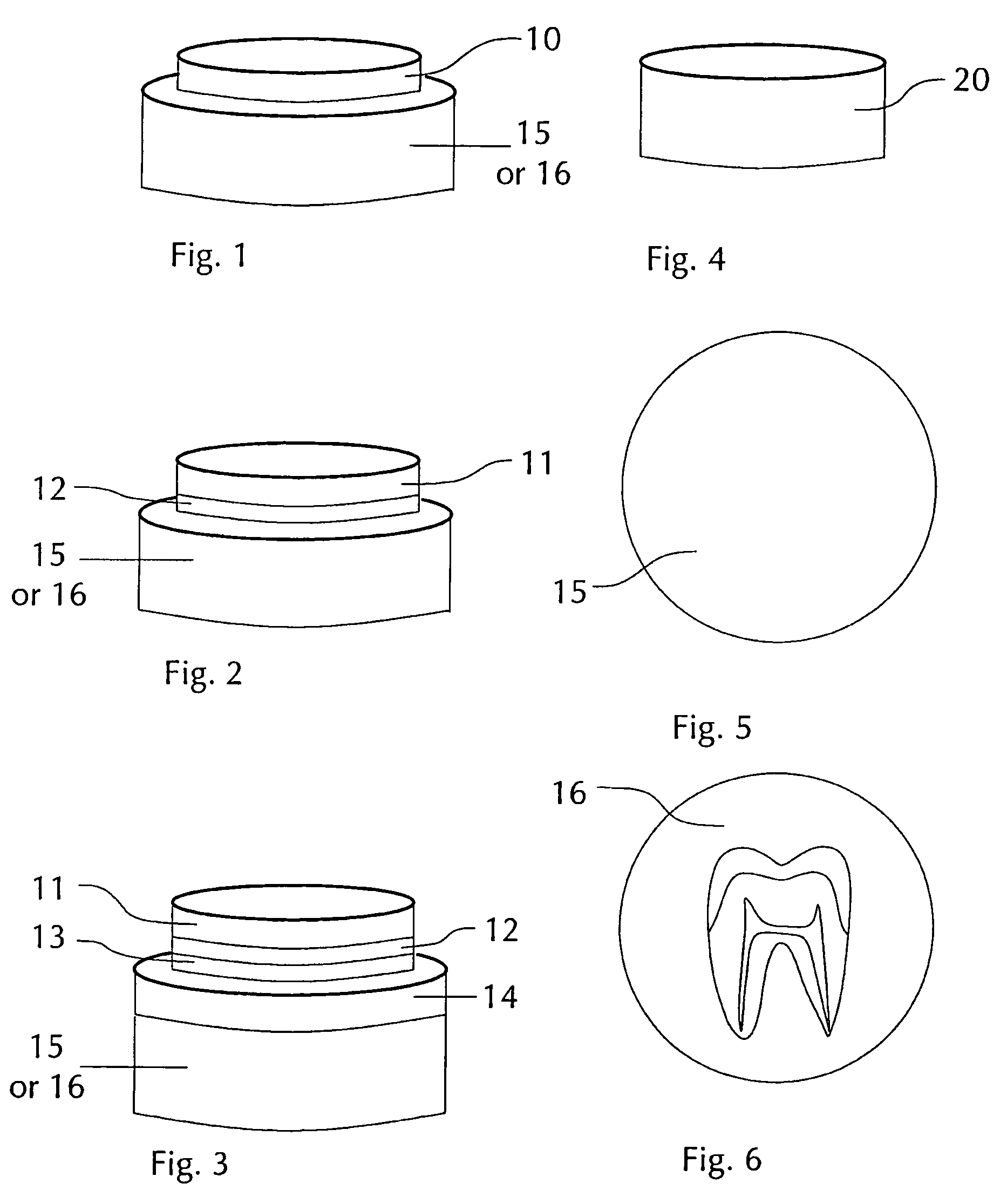 Method and apparatus for selecting non-opacious dental materials