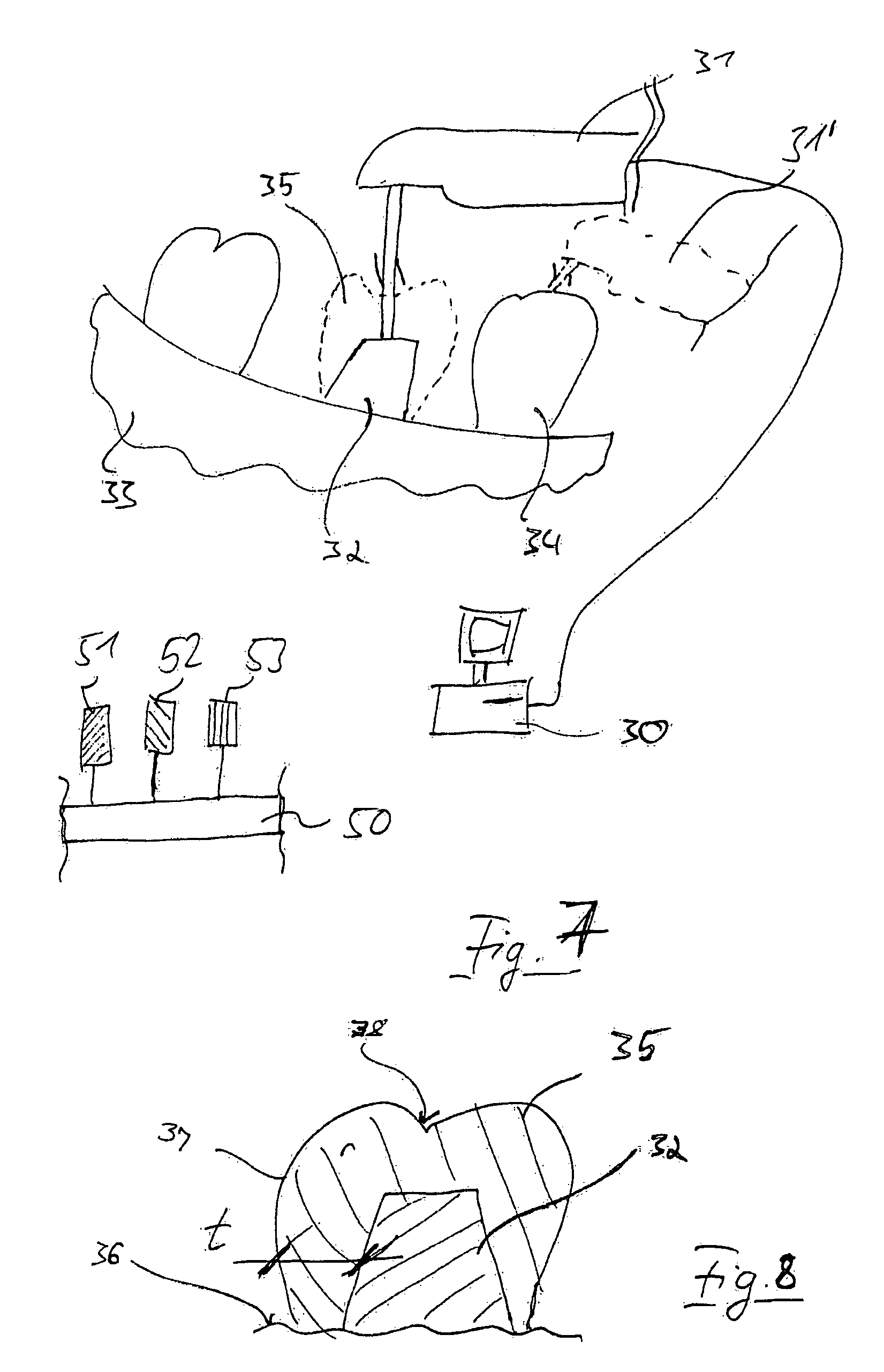 Method and apparatus for selecting non-opacious dental materials
