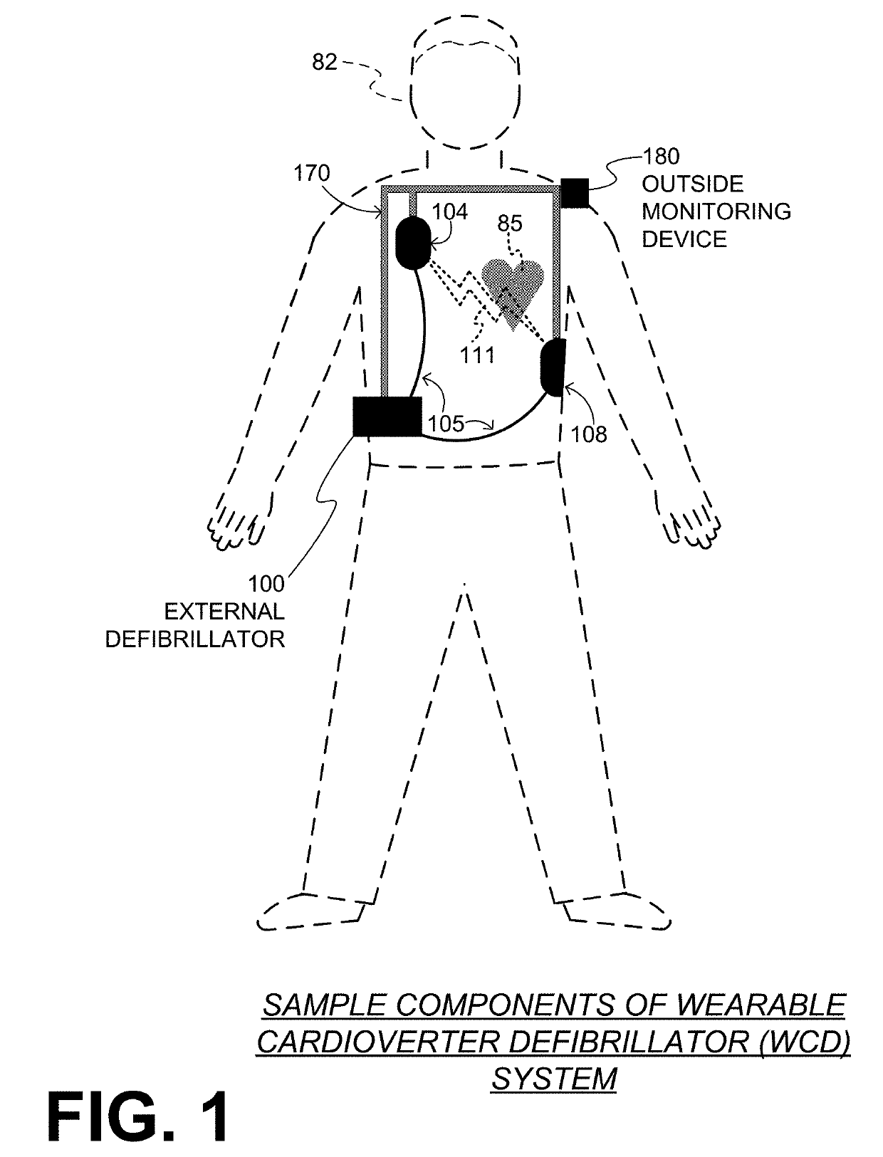 Wearable cardioverter defibrillator (WCD) system detecting ventricular tachycardia and/or ventricular fibrillation using variable heart rate decision threshold
