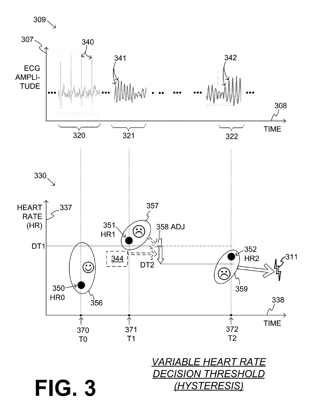 Wearable cardioverter defibrillator (WCD) system detecting ventricular tachycardia and/or ventricular fibrillation using variable heart rate decision threshold