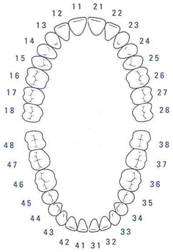 Direct step-by-step method for generating tooth correcting state