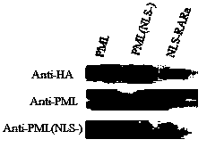 Preparation of anti-PML protein nuclear location signal antibody and application thereof in APL diagnosis