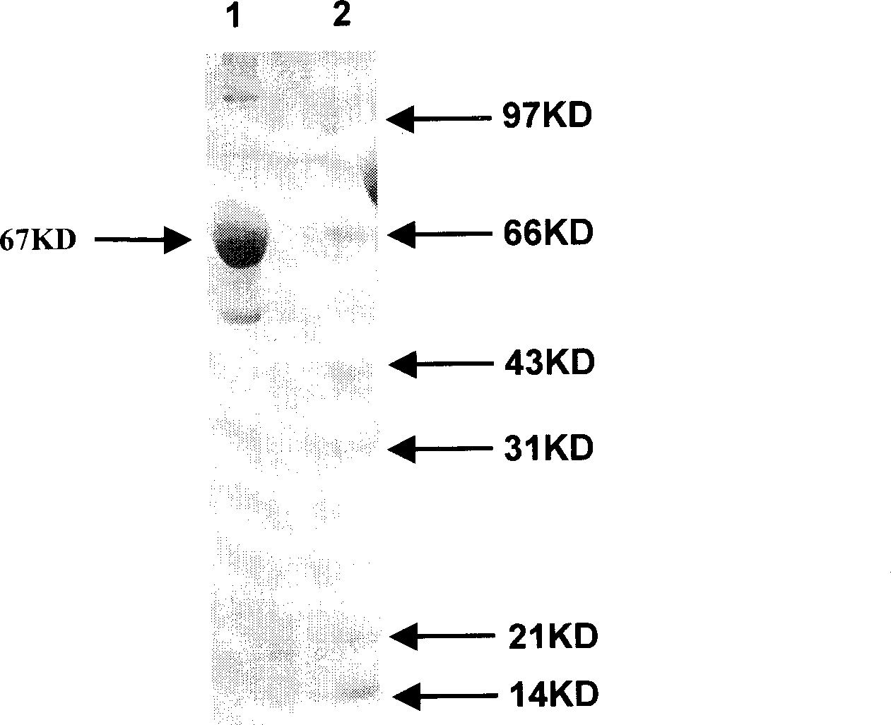 Heat shock protein 65- multiple epitope hepatitis B virus core antigen recombinant protein (HSP65-HBcAg)