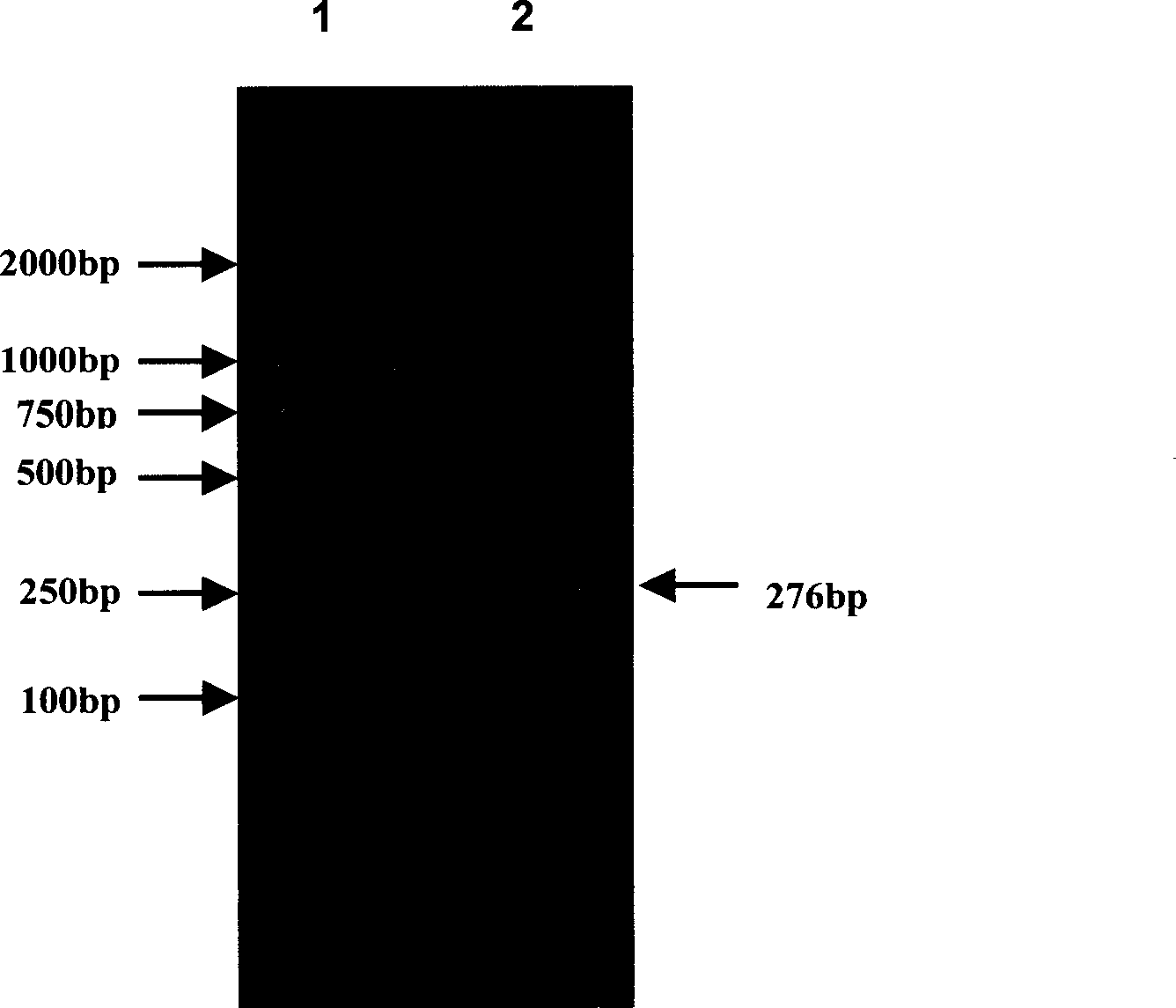 Heat shock protein 65- multiple epitope hepatitis B virus core antigen recombinant protein (HSP65-HBcAg)