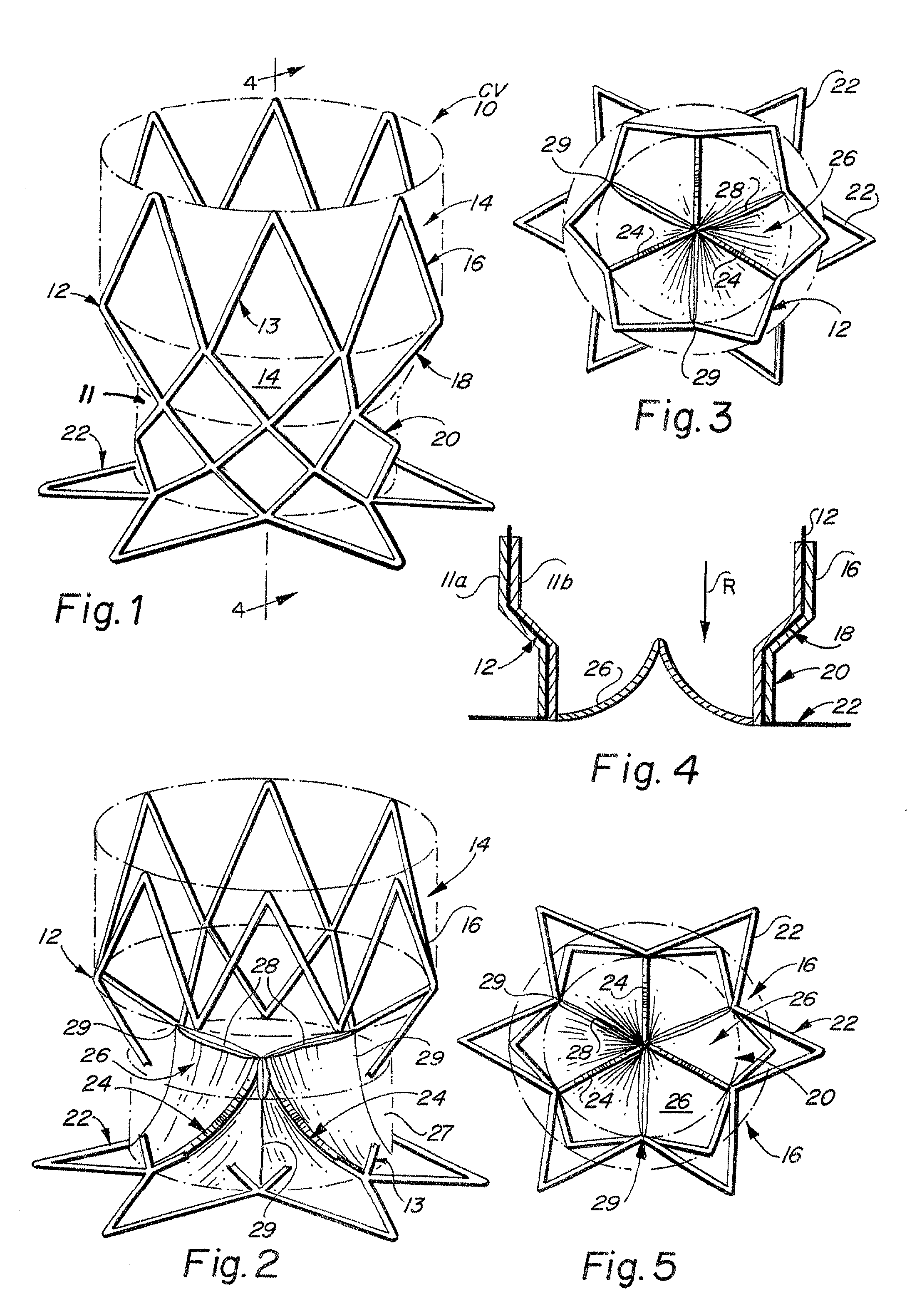 Valvular prostheses having metal or pseudometallic construction and methods of manufacture