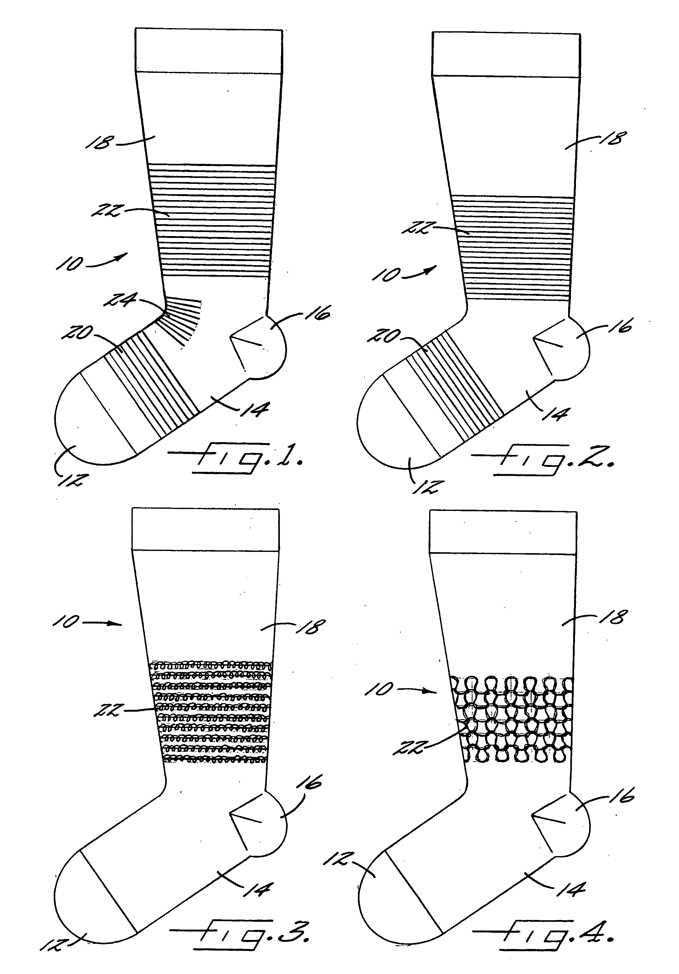 Compression garment with integral donning aid