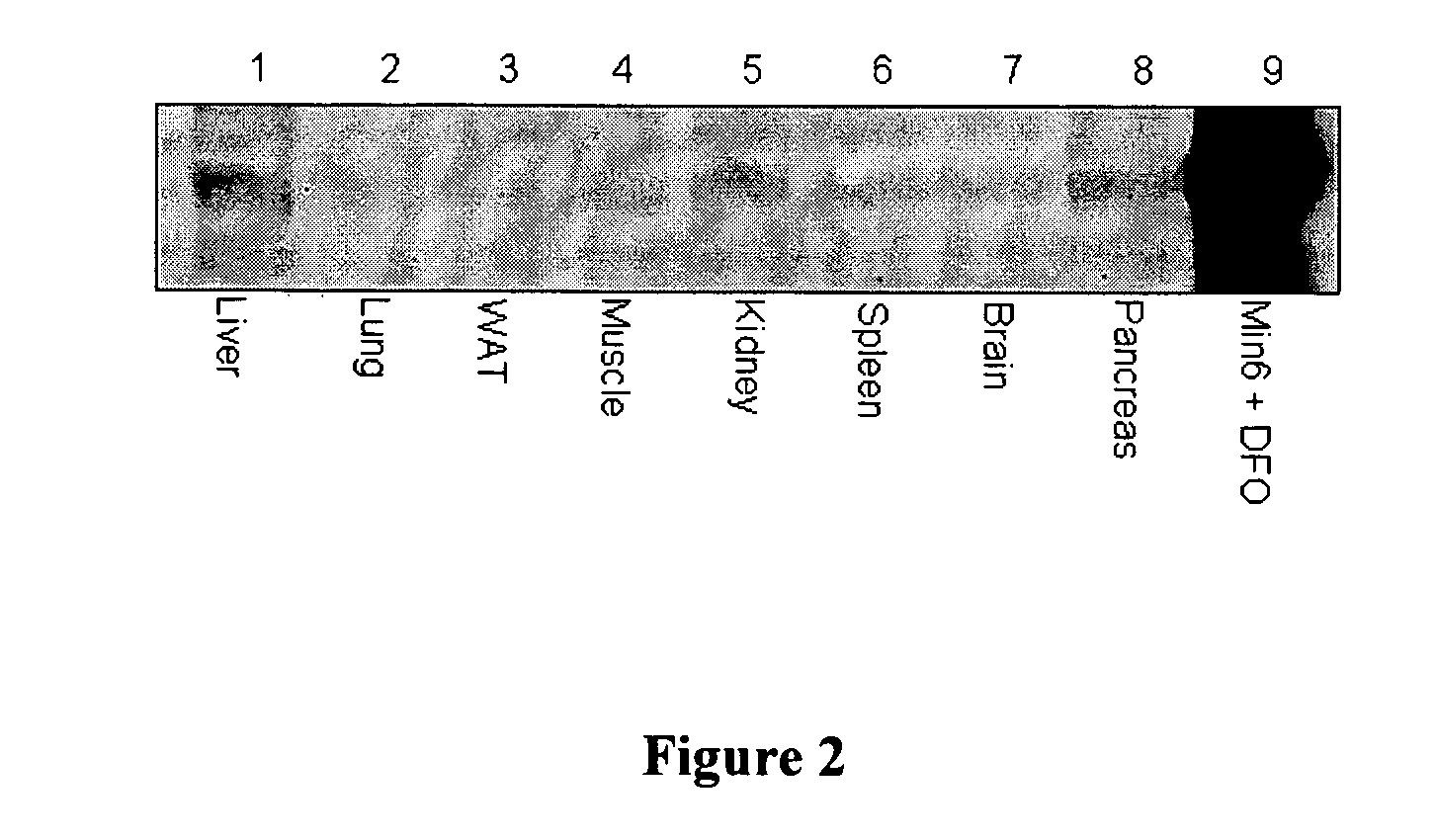 Method of treating diabetes