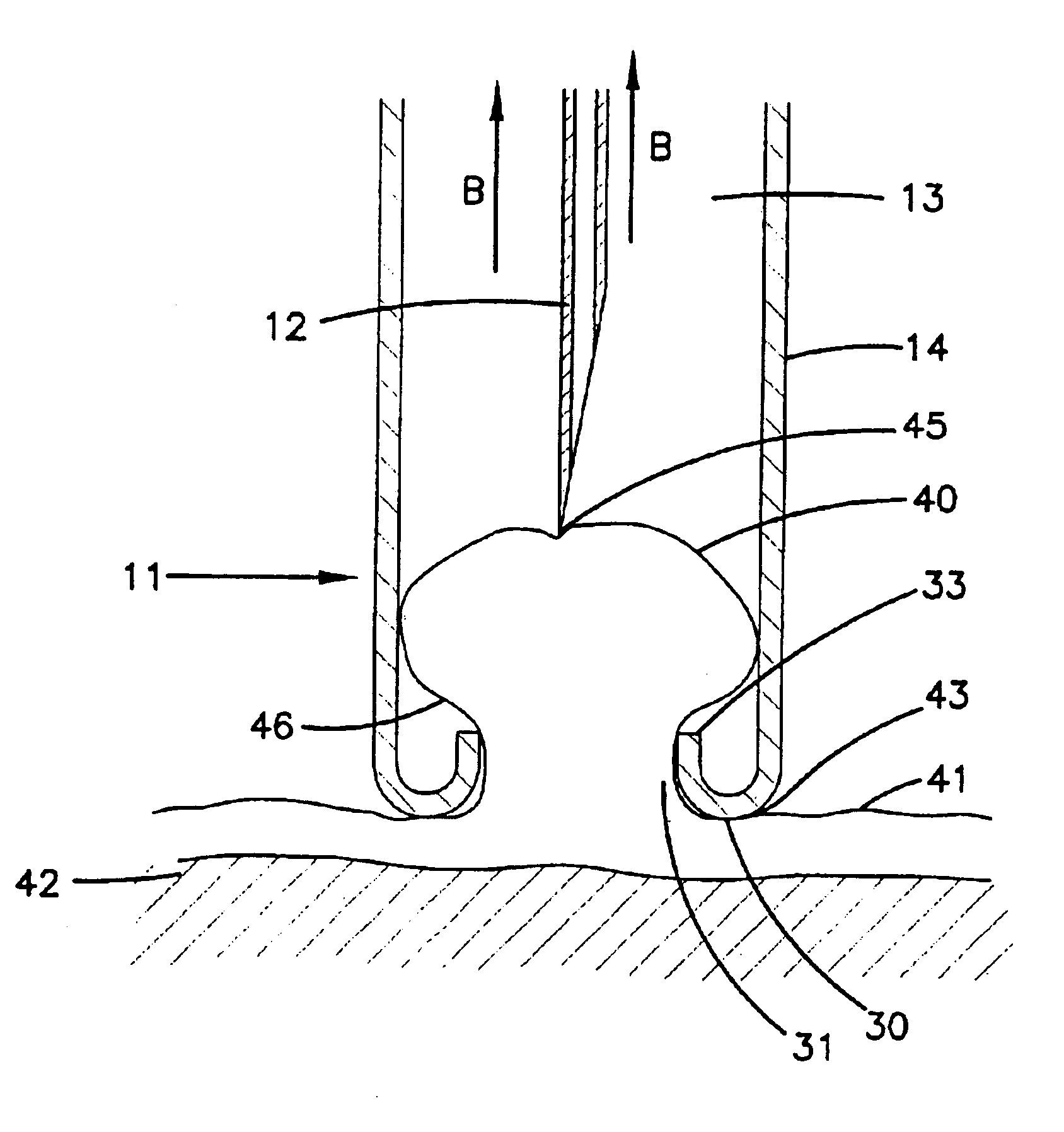 Direct pericardial access device and method