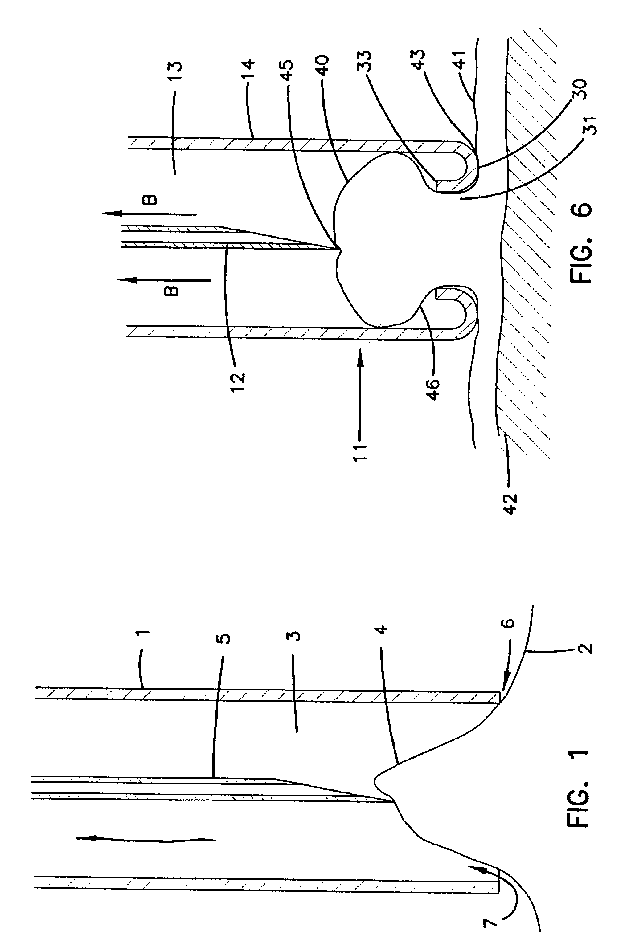 Direct pericardial access device and method