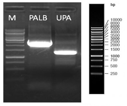 PAlb-uPA slow virus vector and preparation method and application thereof
