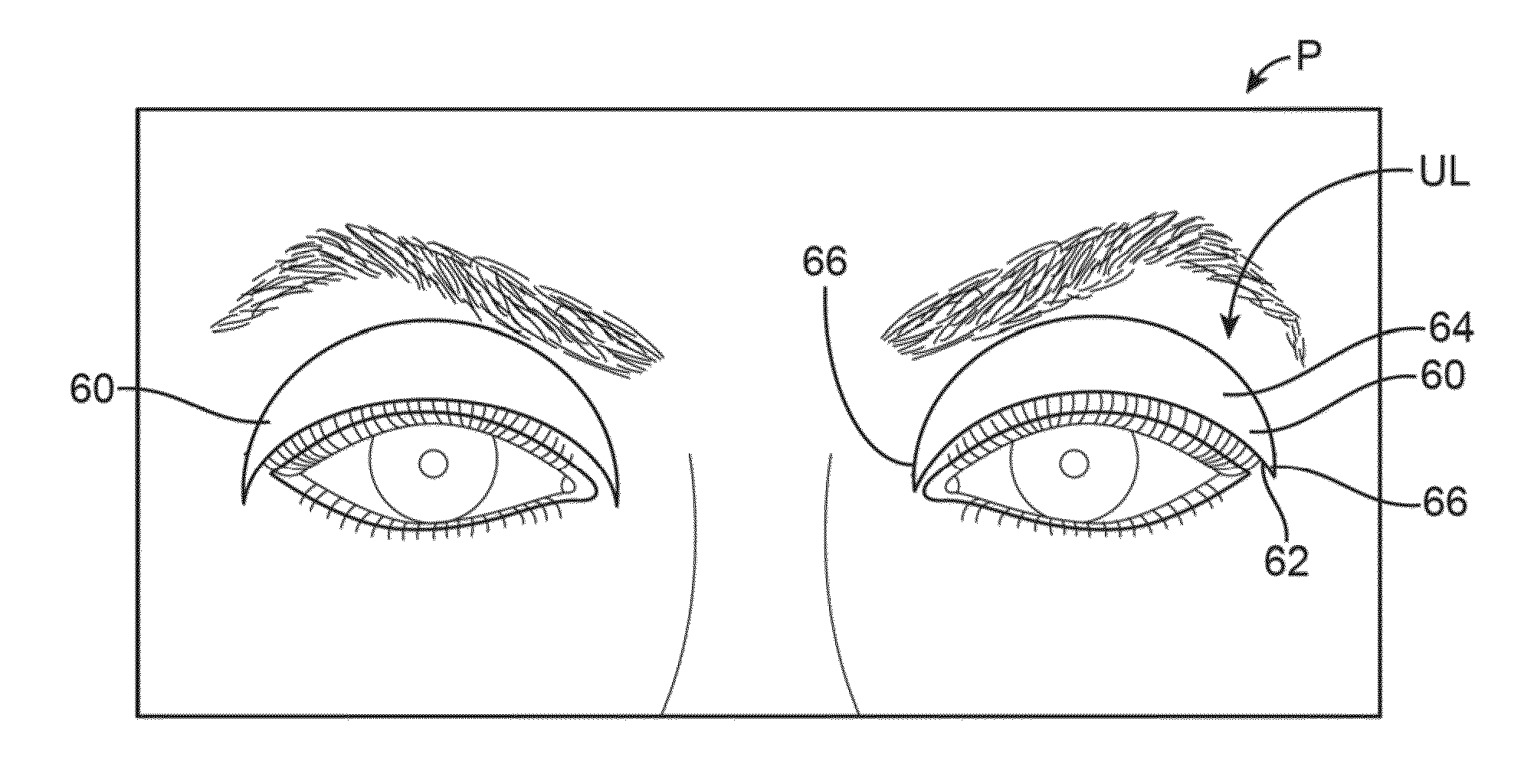 Controller for dry eye treatment systems