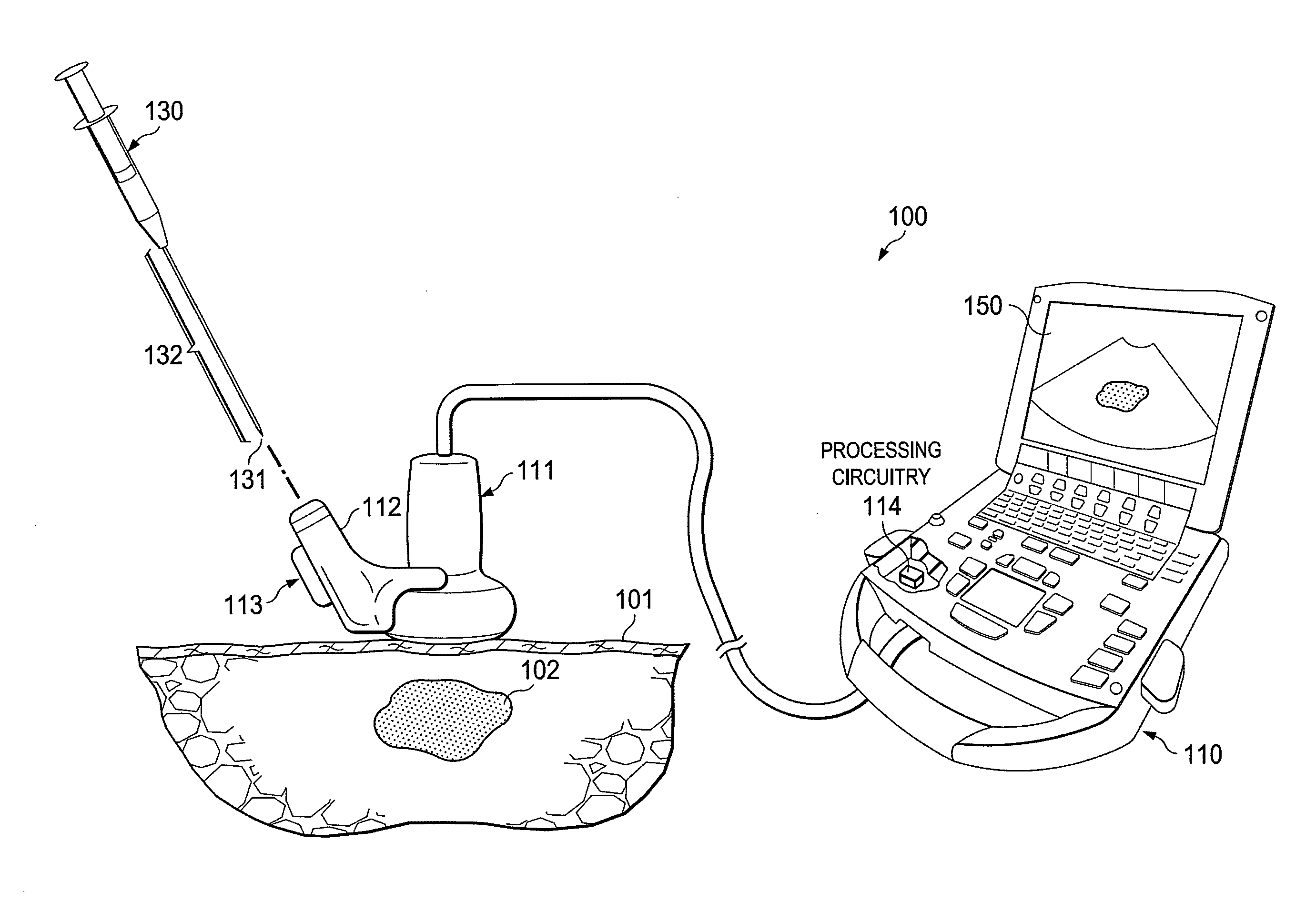 Systems and methods for assisting with internal positioning of instruments