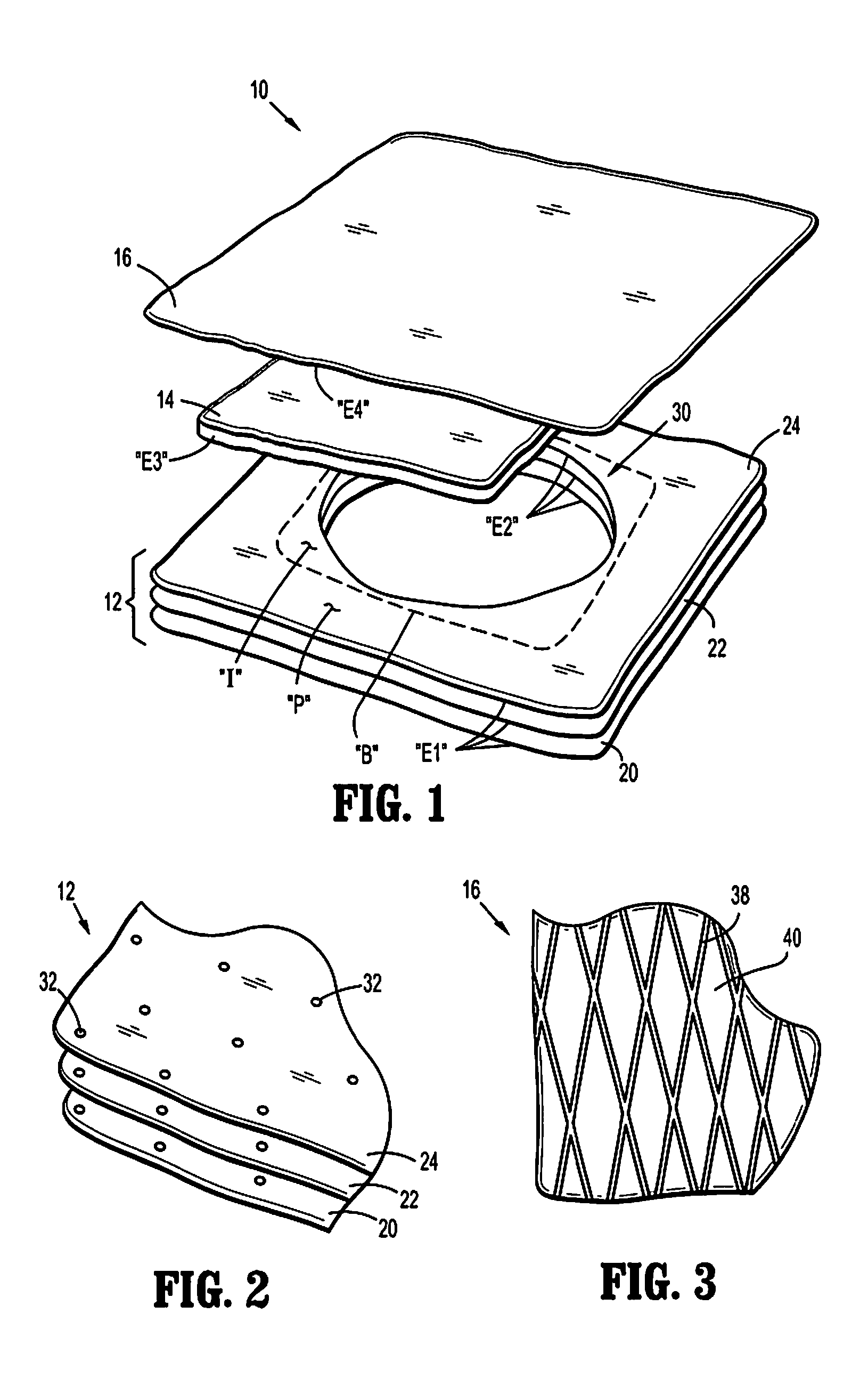Wound dressing with advanced fluid handling