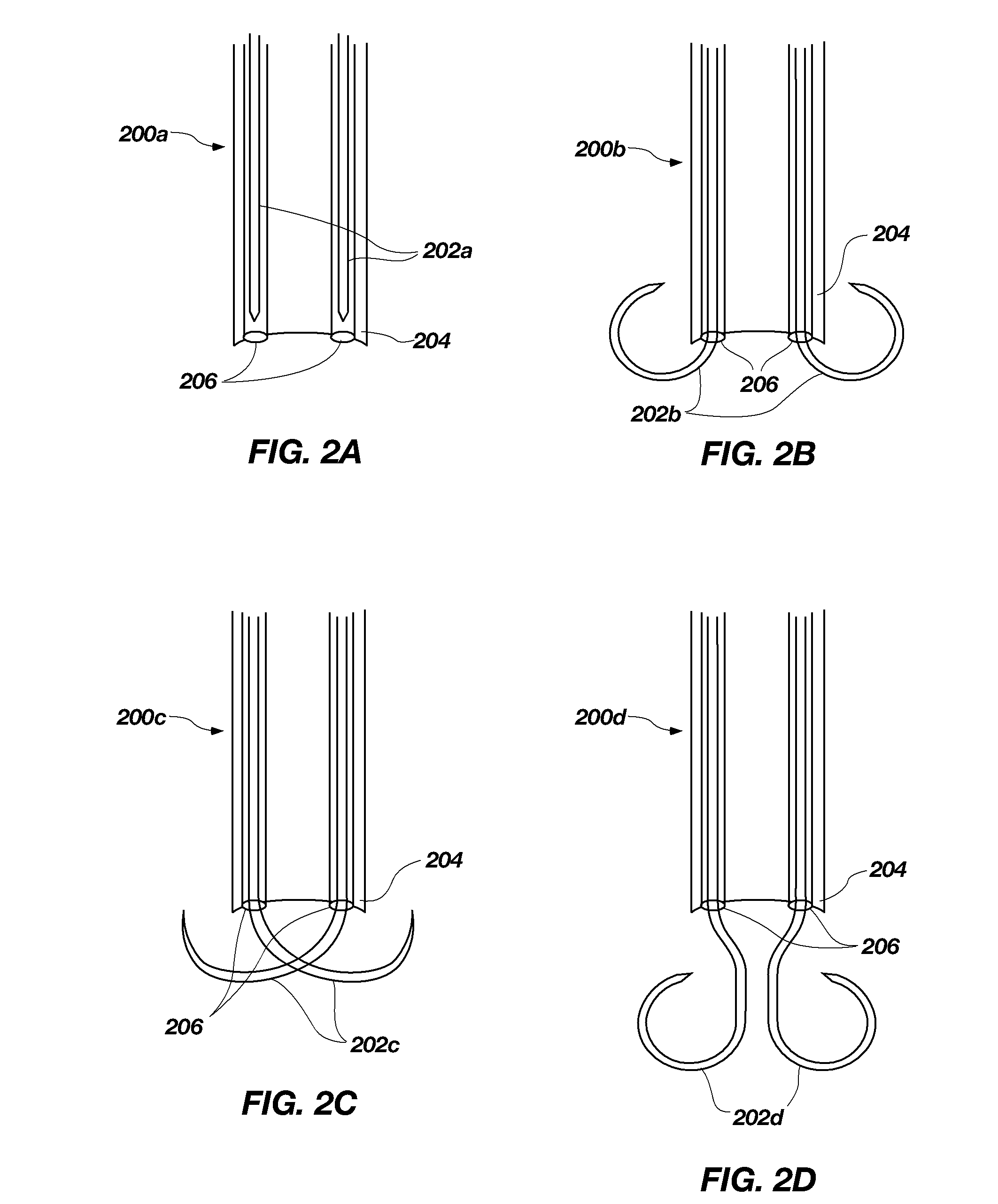 Redundant Tissue Closure Methods and Apparatuses