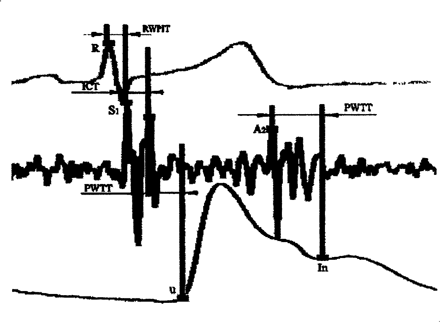 Method and apparatus for obtaining sphygmus wave conducting time in continuously measuring artery blood pressure by sphygmus wave method