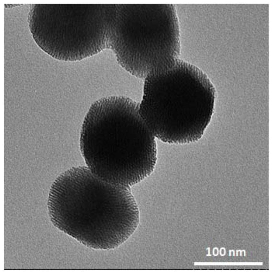 An acid-responsive mesoporous silicon nanomedicine and its preparation method and application