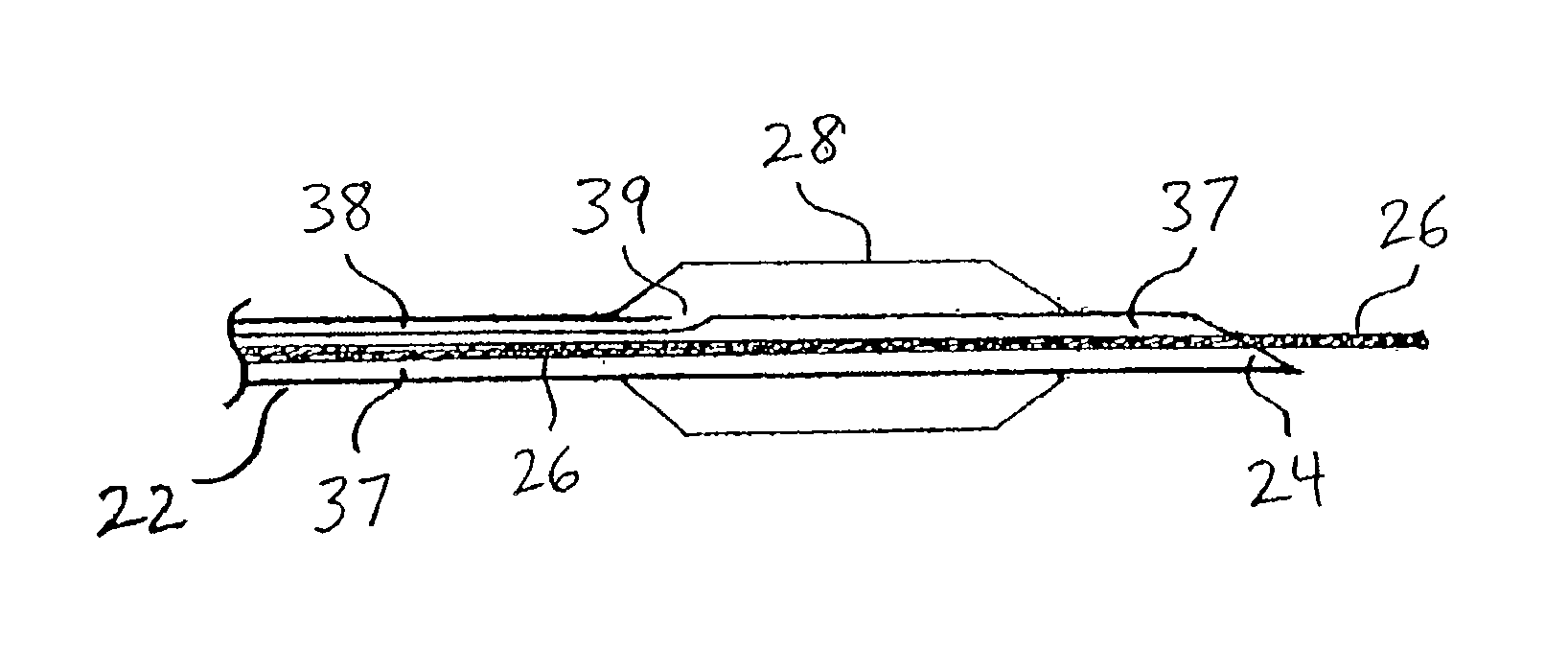 Apparatus and methods for endoscopic resection of tissue