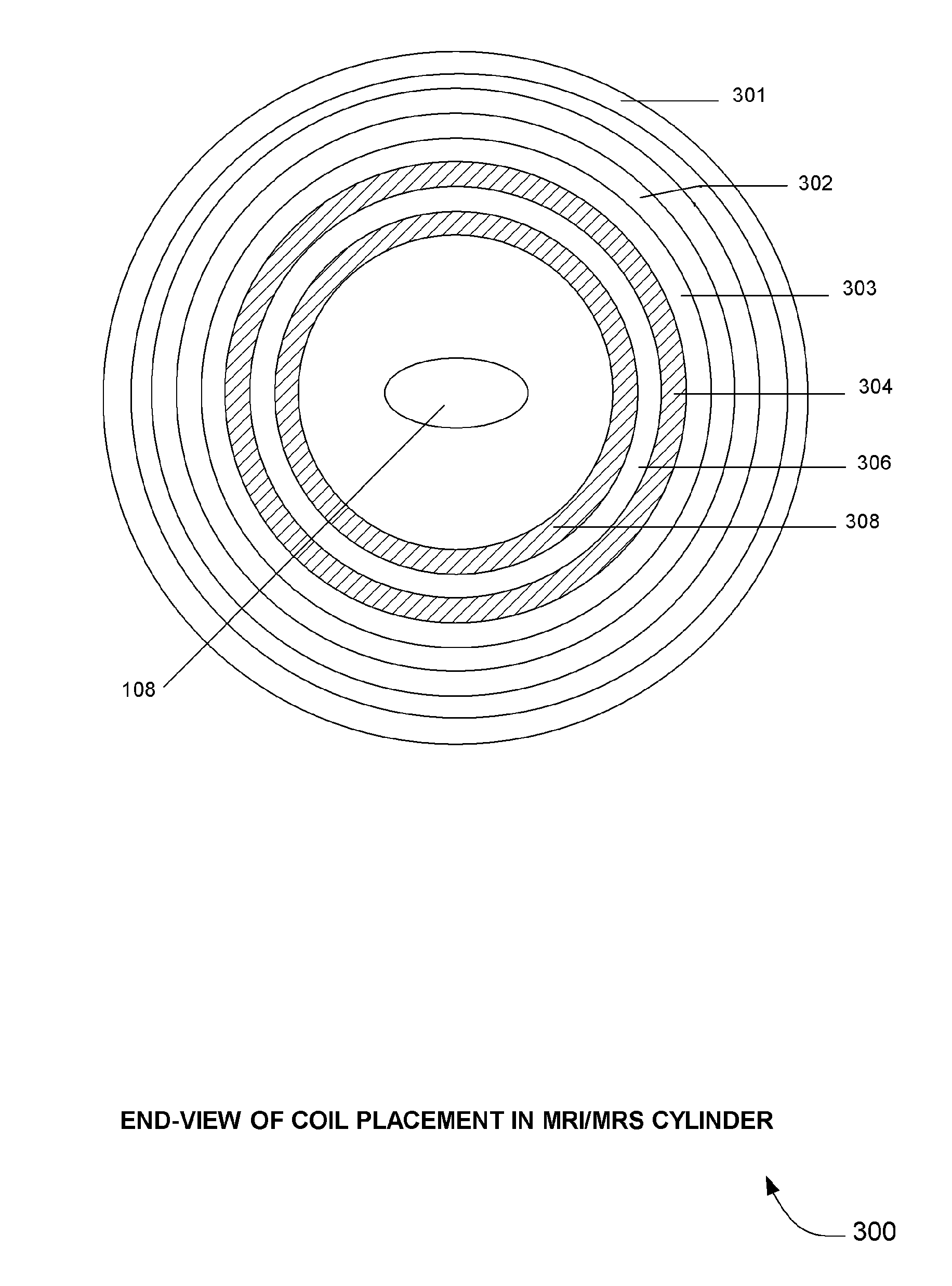 MRI/MRS gradient coil with integrated cooling circuits