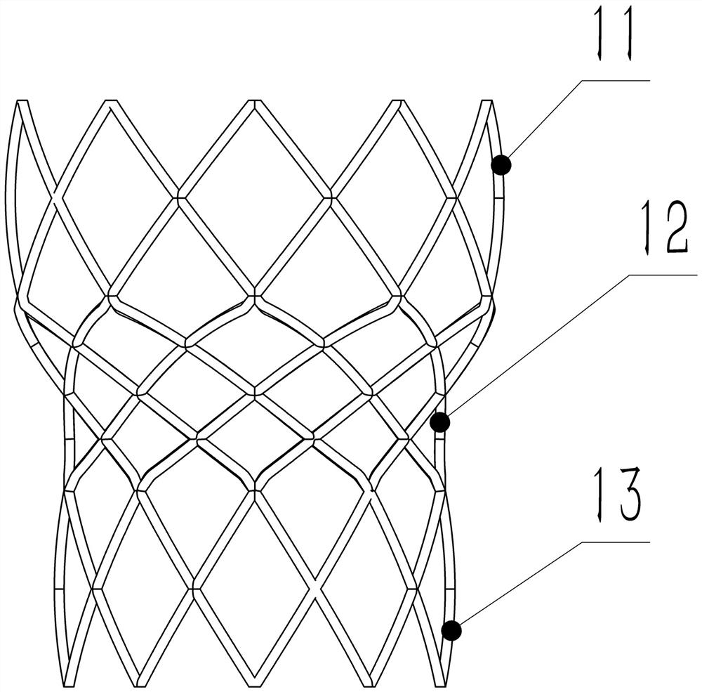 Aortic valve composite implant valve system and using method