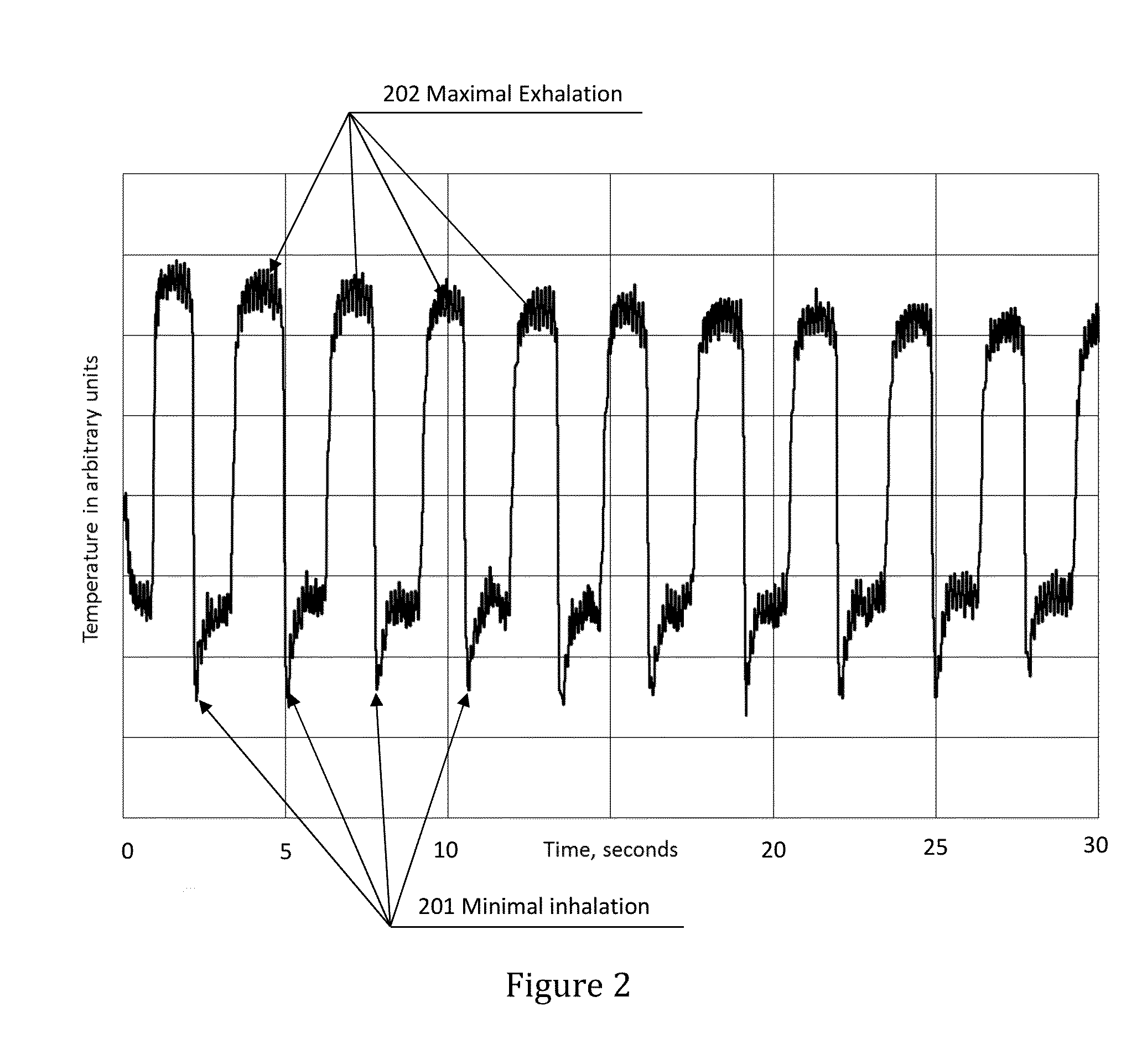 Non-invasive method and apparatus for determining lung tissue thermal properties and for extra vascular lung water measurement